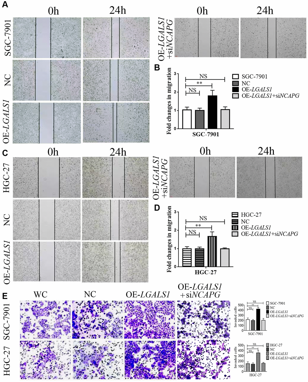 LGALS1 promotes the migration and invasion of GC cell lines in vitro. Overexpression of LGALS1 (OE-LGALS1) significantly enhanced the migration capacity of (A, B) SGC-7901 and (C, D) HGC-27 cells compared with wild control (WC) and negative controls (NC). The migration capacity was abolished when NCAPG was simultaneously silenced. Magnification: ×100. (E) Transwell assay showing that overexpressed LGALS1 significantly enhanced the invasion ability of SGC-7901 and HGC-27 cells, and simultaneous silencing of NCAPG abolished the invasion capacity (n = 3). Magnification: ×200. Abbreviations: NC: negative control (empty vector); OE-LGALS1: Overexpression LGALS1; OE-LGALS1+siNCAPG: Overexpression of LGALS1 +silencing of NCAPG. NS: not significant. **P 