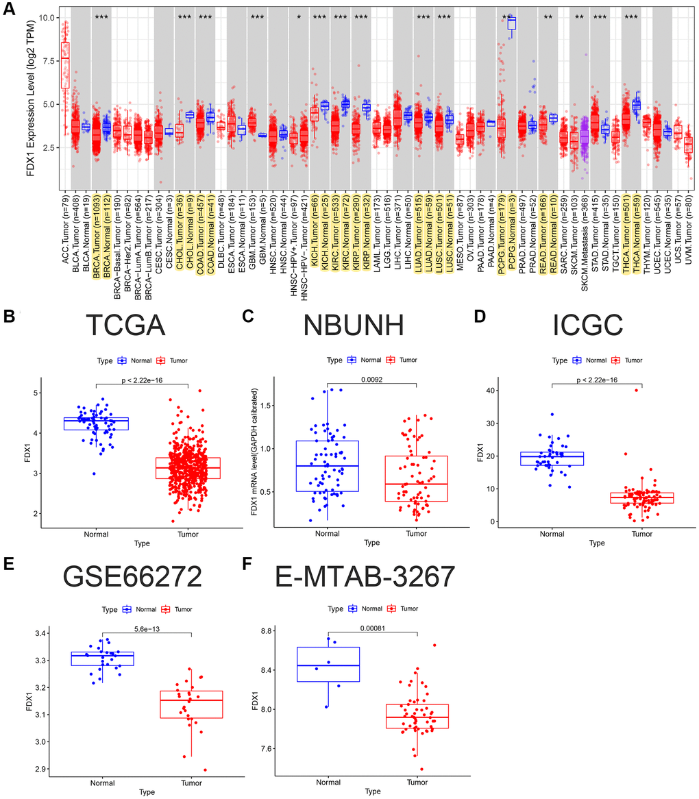 FDX1 pan-carcinoma analysis and mRNA expression levels in ccRCC. (A) Expression levels of FDX1 in pan-carcinoma from TCGA dataset. (B) Boxplot of FDX1 expression in TCGA dataset (KIRC) (N = 72, T = 539). (C) Boxplot of FDX1 expression in the NBUNH dataset (N = 75, T = 75). (D) Boxplot of FDX1 expression in the ICGC dataset (RECA-EU) (N = 45, T = 91). (E) Boxplot of FDX1 expression in the GEO dataset (GSE66272) (N = 25, T = 26). (F) Boxplot of FDX1 expression in ArrayExpress dataset (E-MTAB-3267) (N = 6, T = 53).