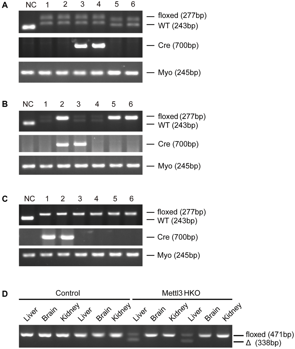 Generation of hepatocyte-specific Mettl3 knockout mice. (A) The offspring mice with different genotypes from intercrossing Mettl3flox/flox and heterozygous Alb-Cre mice. (B) The offspring mice with different genotypes from intercrossing Mettl3flox/wt; Alb-Cre and Mettl3flox/flox mice. (C) The offspring mice with different genotypes from intercrossing Mettl3flox/flox; Alb-Cre and Mettl3flox/flox mice. (D) PCR-based genotyping of genomic DNA collected from the main organs of METTL3 HKO mice and control mice.