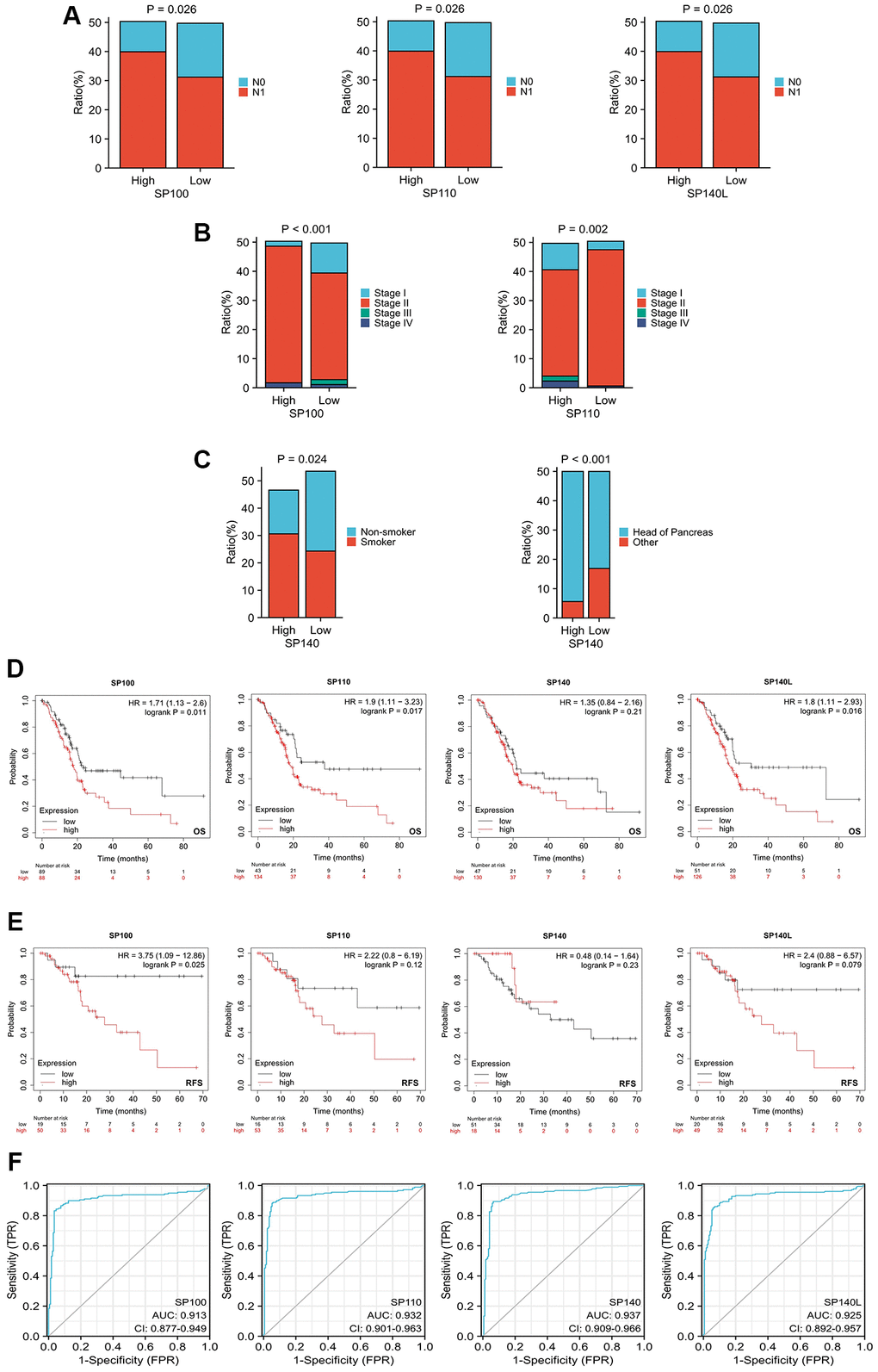 Relationship between expression levels of SP100 family members and clinicopathological features and prognosis of patients with PAAD. (A) The proportion of patients with N1 stage in PAAD patients with high SP100/SP110/SP140L expression was higher; (B) The proportion of patients with Stage IV stage in PAAD patients with high SP100/SP110 expression was higher; (C) The proportion of patients with smoking history and tumors located in the pancreatic head in PAAD patients with high SP140 expression was higher; (D) The increased expression level of SP100/SP110/SP140L were significantly correlated with shorter OS; (E) The increased expression level of SP100 were significantly correlated with shorter RFS; (F) SP100 family members showed high accuracy in predicting normal and neoplastic outcomes.