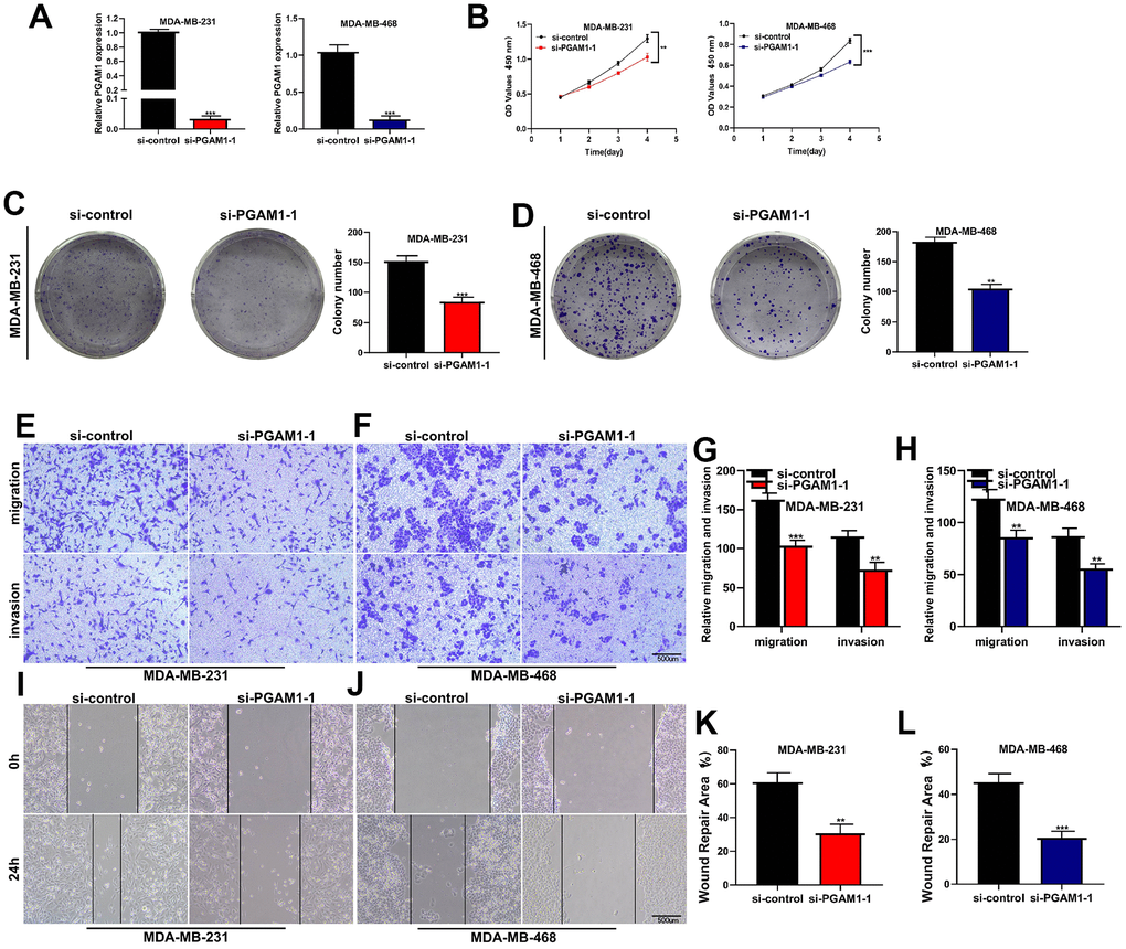 Cell experiments to verify the function of key gene PGAM1. (A) After transfection with SI-PGAM1-1, PGAM1 expression in MDA-MB-231 and MDA-MB-468 cell lines was significantly down-regulated. (B) CCK-8 assay showed that PGAM1 knockdown significantly reduced the activity of both two cell lines. (C) Cloning formation assay of MDA-MB-231 cell line. PGAM1 knockdown significantly reduced the proliferation ability of breast cancer cells. (D) Cloning formation assay of MDA-MB-468 cell line. (E) Transwell experiment of MDA-MB-231 cell line. PGAM1 knockdown significantly reduced the invasion and migration of breast cancer cells. (F) Transwell experiment of MDA-MB-468 cell line. (G) Transwell statistical histogram of MDA-MB-231 cell line. (H) Transwell statistical histogram of MDA-MB-468 cell line. (I) Wound healing experiment of MDA-MB-231 cell line. After PGAM1 knockdown, the healing ability of breast cancer cells was significantly reduced. (J) Wound healing experiment of MDA-MB-468 cell line. (K) Statistical histogram of wound healing experiment of MDA-MB-231 cell line. (L) Statistical histogram of wound healing experiment of MDA-MB-468 cell line. (*ppp