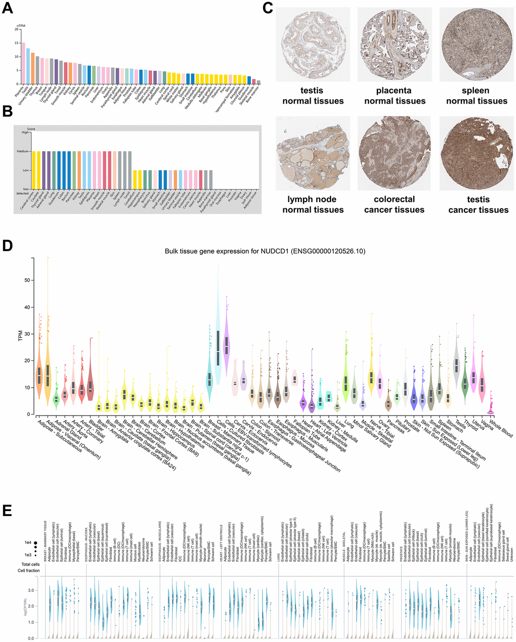 NUDCD1 expression profiles in human normal and cancerous tissues. (A) NUDCD1 expression levels in human tissues based on Internally generated Human Protein Atlas (HPA) RNA-seq data. (B) Protein expression levels of NUDCD1 in human tissues. Protein expression data is shown for each of the 44 tissues from the HPA database. (C) IHC images of NUDCD1 in normal testis tissues, normal placenta tissues, normal spleen tissues, normal lymph node tissues, colorectal cancer tissues, and testis cancer tissues from HPA. (D) Bulk tissue gene expression and (E) single tissue expression for NUDCD1 based on the GTEx database.