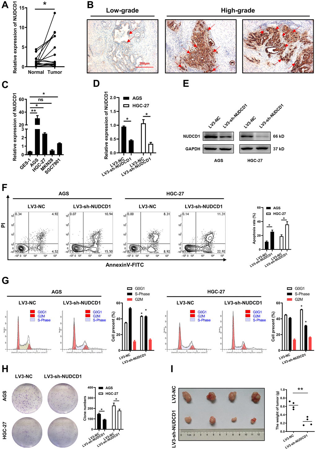 Validation of NUDCD1 expression and function in STAD. (A) Relative NUDCD1 expression in STAD tissues and adjacent pericarcinous tissues. (B) Immunohistochemistry analysis of NUDCD1 expression in STAD tissues. (C) Relative NUDCD1 expression in the normal gastric mucosal cell line, GES-1, and four STAD cell lines, AGS, HGC-27, MKN28 and SGC7901. (D) Relative mRNA and (E) protein expression of NUDCD1 in AGS and HGC-27 cells with LV3-NC or LV3-sh-NUDCD1. (F) The ratio of apoptosis in AGS and HGC-27 cells with LV3-NC or LV3-sh-NUDCD1. (G) Cell cycle in AGS and HGC-27 cells with LV3-NC or LV3-sh-NUDCD1. (H) Colony formation assay results in AGS and HGC-27 cells with LV3-NC or LV3-sh-NUDCD1. (I) Weight of subcutaneously xenografted STAD in nude mice.