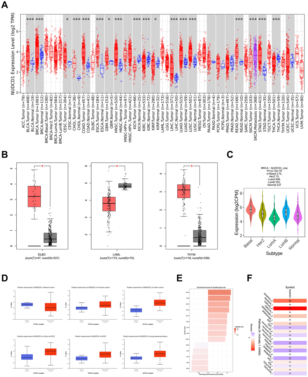 NUDCD1 expression levels in different types of human cancers. (A) NUDCD1 expression levels in different cancers and specific cancer subtypes from TIMER2. (B) NUDCD1 expression levels in DLBC, LAML and THYM (data from GEPIA2). (C) Expression status of the NUDCD1 gene in BRCA subtypes (data from TISIDB). (D) Expression levels of NUDCD1 total protein in breast cancer, ovarian cancer, colon cancer, clear cell RCC, UCEC and lung adenocarcinoma (data from UALCAN). (E) Enrichment scores for NUDCD1 in different cancers (data from GSCA). (F) Pathways affected by NUDCD1 mRNA expression (data from GSCA).