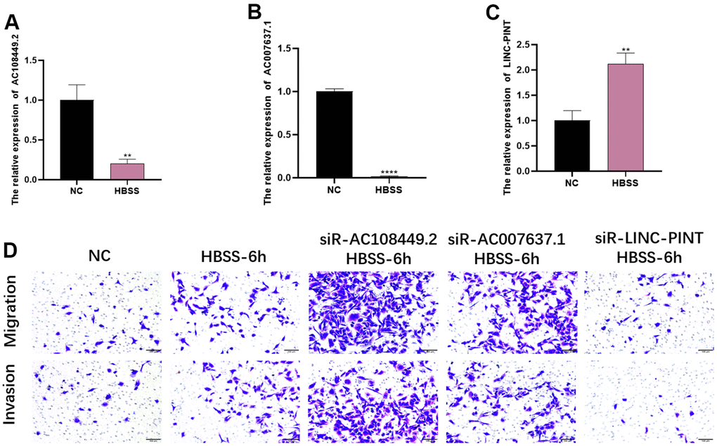 The effects of LINC-PINT, AC108449.2 and AC007637.1 on invasion and migration in the starvation condition. The expression levels of AC108449.2 and AC007637.1 (A, B) decreased in the starvation condition, but LINC-PINT (C) increased in that condition. The migration and invasion abilities of cells in starvation-condition were more robust than that in normal-condition. The knock-down of AC108449.2 and AC007637.1 could increase the starvation-induced migration and invasion ability of cells, while the deficiency of LINC-PINT significantly decreased those abilities induced by starvation (D).