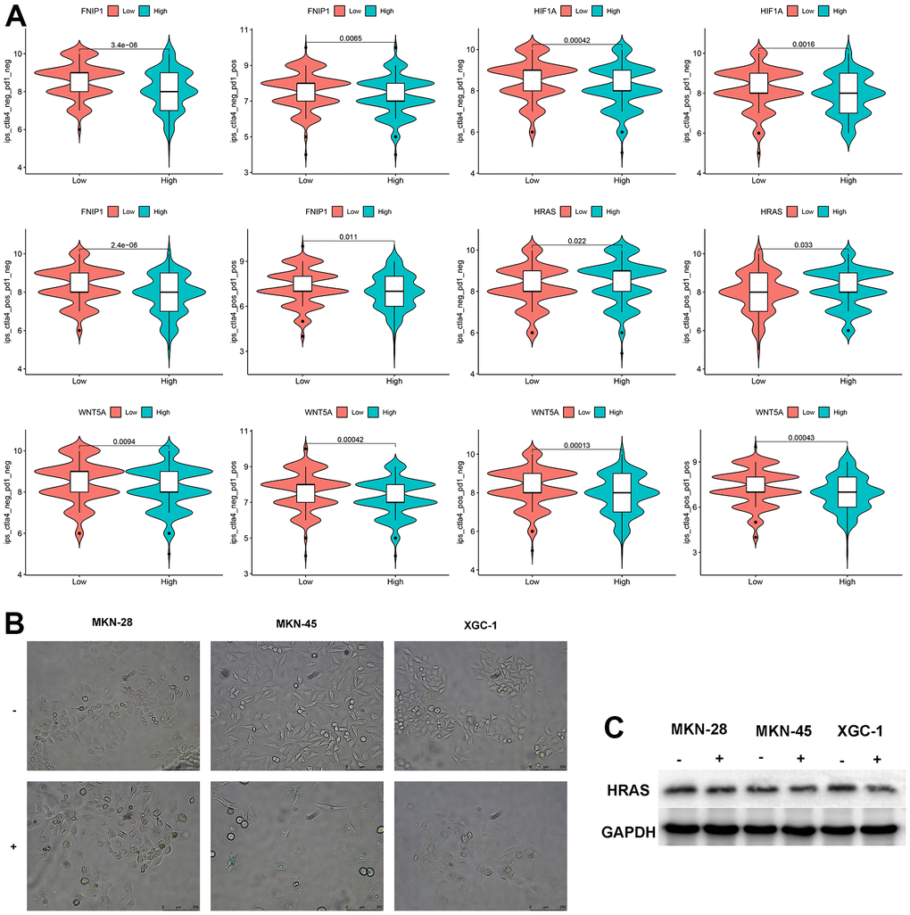 Analysis of feature genes. (A) The impact of characteristic genes on immunotherapy. (B) Bleomycin-induced cellular senescence (bar=250μm) (“-“represents the control group, “+” represents bleomycin induction). (C) Changes in HRAS expression levels after cellular senescence.