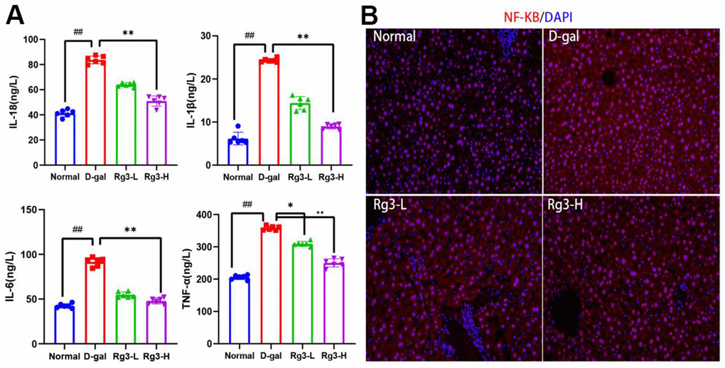 Expression levels of inflammatory related factors induced by Rg3 on D-gal in mice. (A) Serum inflammatory cytokines in mice. (B) Immunofluorescence section of NF-KB in mouse liver. Results are represented by mean±S.D. #p