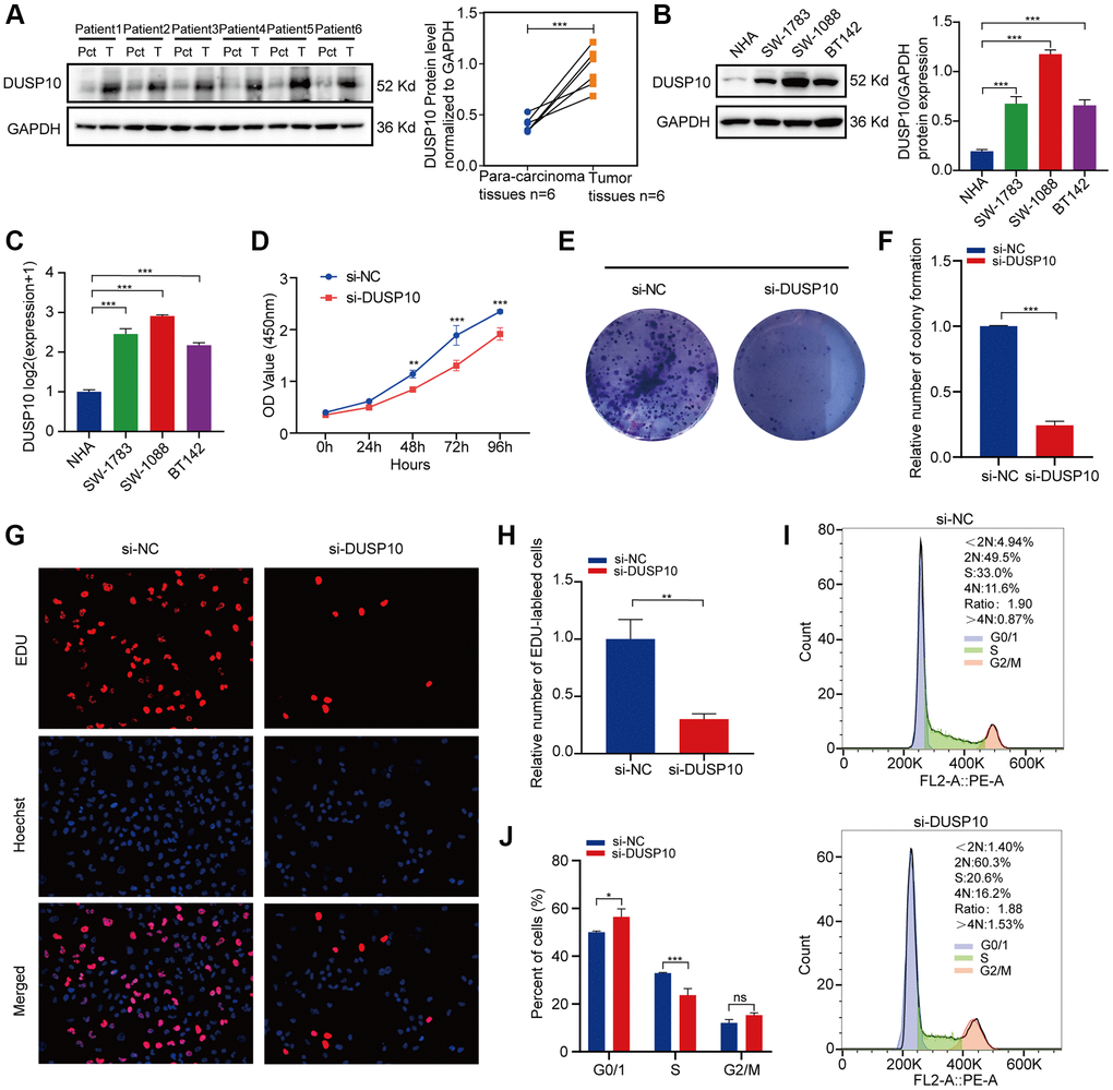 In vitro experiments verification of DUSP10 in LGG. (A) Western blot analysis of DUSP10 expression in LGG tissues and corresponding para-carcinoma tissues. (B) Western blot and (C) qRT-PCR analysis of DUSP10 expression in NHA and LGG cell lines. (D) The cell viability of si-DUSP10-transfected and si-NC-transfected SW1088 cells by CCK-8 assays. (E, F) Effect of DUSP10 knockdown on colony formation was counted in SW1088 cells. (G, H) Representative images (G) and histogram analysis (H) of EdU assays after DUSP10 knockdown in SW1088 cells. (I, J) Cell cycle assays were implemented to evaluate the cell distribution of the SW1088 cell lines transfected with si-DUSP10 or si-NC lentiviruses. *P **P ***P 