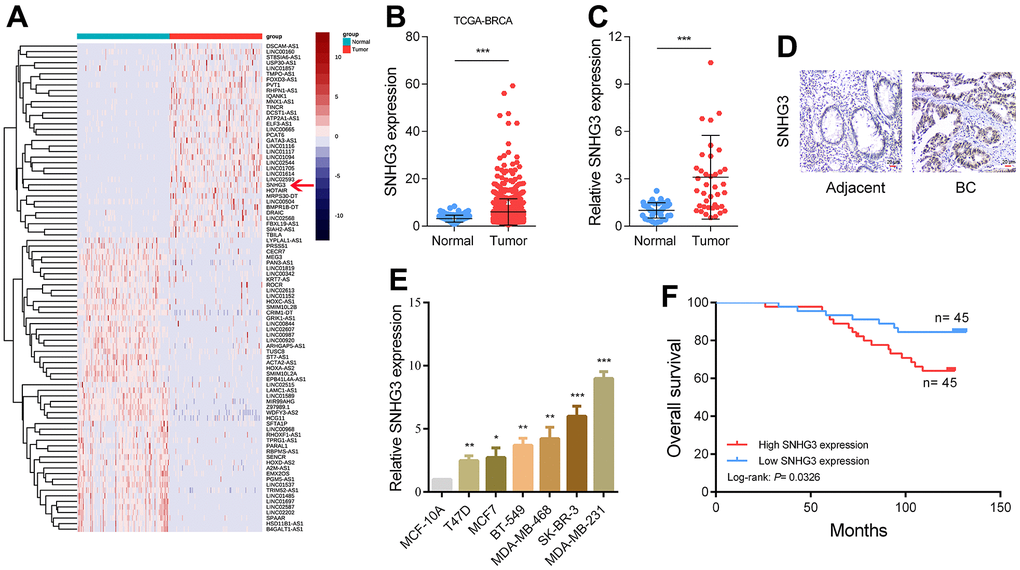 SNHG3 expression is upregulated in BC and high SNHG3 expression predicts poor prognosis. (A) Hierarchical cluster heat map of aberrantly expressed lncRNAs in BC generated from RNA sequencing data from the TCGA database. Red in the heat map denotes upregulation, while blue denotes downregulation. The red line indicates SNHG3. (B) Expression of SNHG3 in TCGA BC cohorts. (C) qRT-PCR analysis of SNHG3 expression in 40 pairs of BC and corresponding normal tissues. (D) ISH analysis of SNHG3 expression in BC and corresponding normal tissues. (E) SNHG3 expression in BC cell lines (T470, MCF7, BT-549, MDA-MB-468, SK-BR-3 and MDA-MB-231) compared with normal breast epithelial cell line MCF-10A detected by qRT-PCR. (F) Kaplan–Meier survival analysis of BC patients’ overall survival based on their SNHG3 expression.