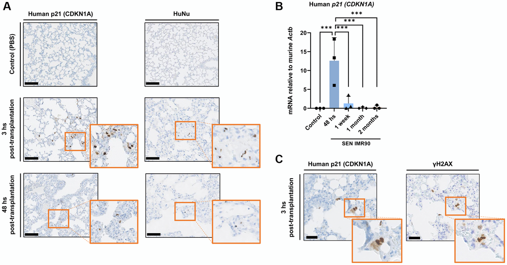 Senescent human lung fibroblasts infiltration and engraftment in mice lungs. (A) Images of lung sections showing IHC staining for CDKN1A/p21Cip1/Waf1 (left panel) and HuNu (right panel) from mice injected with SEN-IMR90 or control. Engraftment of senescent cells (arrows) in mice sacrificed after 3 and 48 hours post-transplantation. Positive cells were confirmed using histology at low magnification (20×, scale bar 100 μm), and high magnification (40×, orange box). (B) RT–PCR expression of CDKN1A/p21Cip1/Waf1 was measured relative to murine Actin-b to demonstrate the engraftment of SEN-IMR90 in the lungs of nude mice after 48 hours post-transplantation, and their presence at later endpoints compared to control; n = 3 each group. Statistical significance was assessed by the one-way ANOVA with Tukey test: ***p C) Serial section and staining with antibodies against human CDKN1A/p21Cip1/Waf1 and Phospho-H2AX (γ-H2AX) to demonstrate senescence state of the engrafted cells. For further explanations, see text.