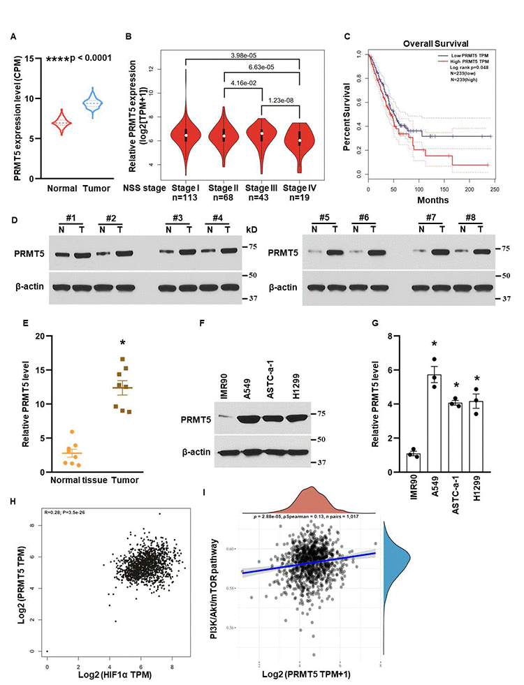 Overexpression of PRMT5 results in human lung cancer progression. (A) PRMT5 mRNA expression level was analyzed in adjacent normal tissues (n=486) and lung tumor tissues (n=338) using TCGA database. ****P B) PRMT5 was closely associated with stages in human lung cancer with analysis of the TCGA database. N=113 for stage I; n=68 for stage II; n=43 for stage III and n=19 for stage IV. P C) PRMT5 expression level was negatively correlated with the patient’s overall survival with TCGA database analysis. n=239 for PRMT5-low group and PRMT5-high group. P values were determined by log-rank test and p=0.048. (D) PRMT5 protein expression levels were assessed by Western blotting in adjacent normal tissues (N) and lung tumor tissues (T). (E) PRMT5 protein expression levels were quantified in adjacent normal tissues and lung tumor tissues (n=8, each group). *P F) PRMT5 protein expression was detected by Western blotting in the indicated cell lines. (G) PRMT5 protein expression levels were quantified in the indicated cell lines. (n=3). *P H, I) The correlations between PRMT5 and HIF-1α or PI3K/Akt pathway were analyzed. The correlations between individual gene and pathway score were analyzed with Spearman method as well. The abscissa represents the distribution of the gene expression, and the ordinate represents the distribution of the pathway score. The density curve on the right represents the trend in distribution of pathway immune score; the upper density curve represents the trend in distribution of the gene expression. The value on the top represents the correlation p value, correlation coefficient and correlation calculation method.