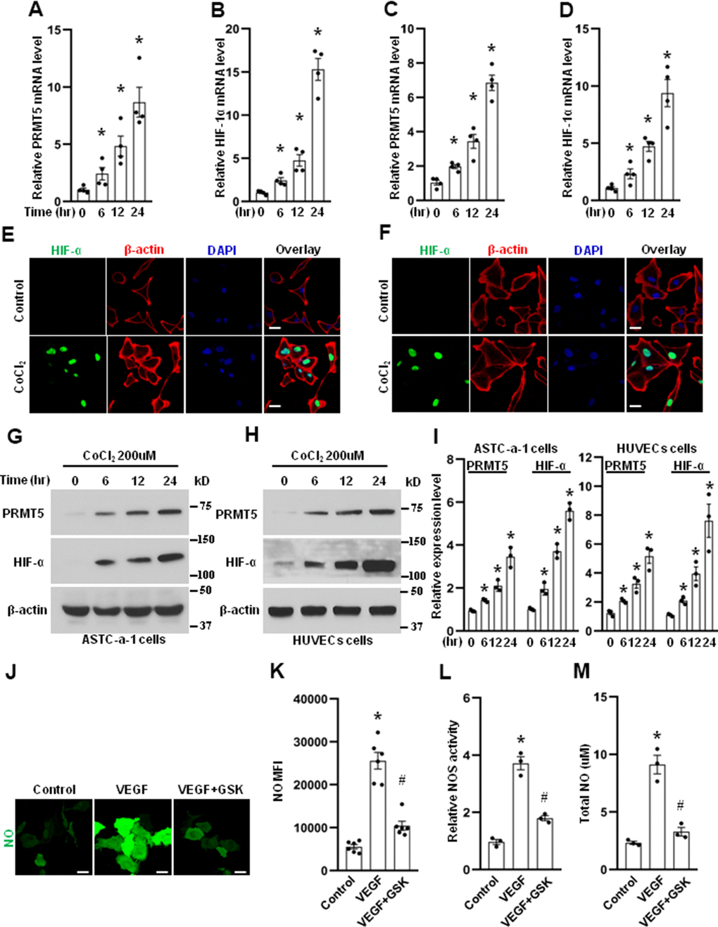 PRMT5 is induced by hypoxia. The HUVECs (A, B) and ASTC-a-1 cells (C, D) were treated with CoCl2 (200μM) for indicated time points, and the mRNA expression levels of PRMT5 and HIF-1α were measured by qRT-PCR. *P E) and ASTC-a-1 cells (F) were treated with or without CoCl2 (200μM) for 12h, and the HIF-1α expression induced by CoCl2 was detected by immunofluorescence staining. Representative pictures were shown. Green= HIF-1α; Red=β-actin; Blue=DAPI. Scale Bar=50μm. The ASTC-a-1 cells (G) and HUVECs (H) were treated with CoCl2 (200μM) for indicated time points, and the protein expression levels of PRMT5 and HIF-α were evaluated by Western blotting. (I) PRMT5 and HIF-α protein expression levels were quantified in ASTC-a-1 and HUVECs cells (n=3). *P J) The HUVECs were treated with VEGF (50ng/ml) in the presence or absence of GSK591, and the endothelial NO was monitored by the DAF-FM DA probe. Scale bar=50μm. (K) Quantitation of corresponding MFI values (n=6, each group). *P #P L) NOS enzymatic activity in HUVECs upon treatment of VEGF with or without GSK591 as evaluated by the Griess method. *P #P M) Total NO was measured by ELISA kit using the Griess reaction in the supernatant of HUVECs upon treatment of VEGF (50ng/ml) with or without GSK591. *P #P 