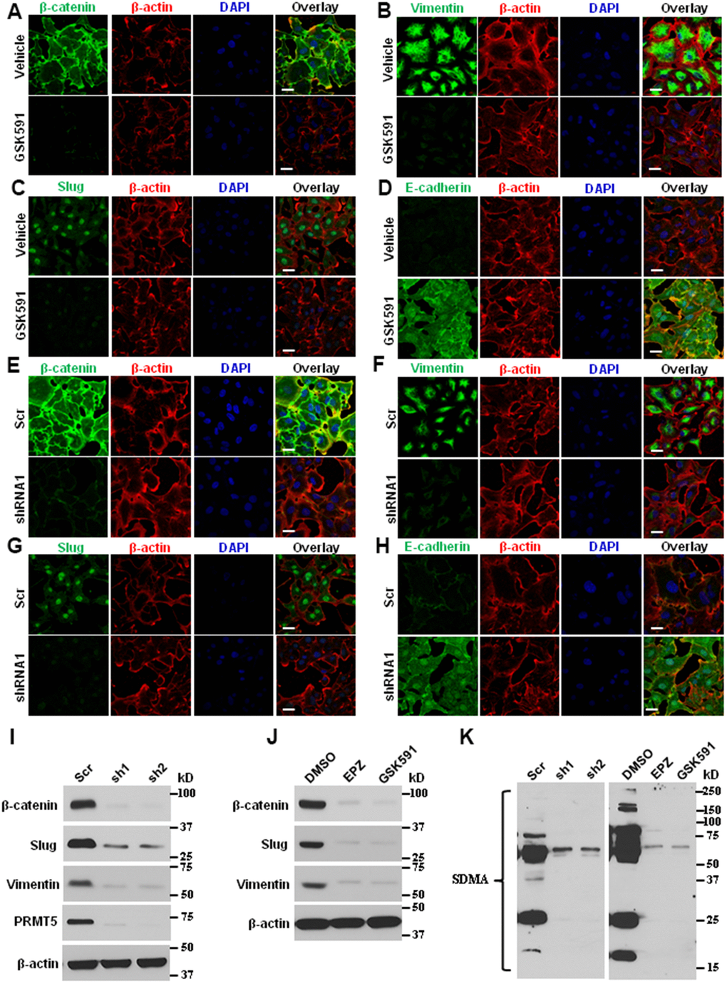 Blocking PRMT5 attenuates lung cancer invasion and metastasis. (A–D) The ASTC-a-1 cells were treated with GSK591 or Vehicle, and the EMT markers (β-catenin, Vimentin, Slug, and E-cadherin) were determined by immunofluorescence. Representative pictures were shown (n=3, each group). Scale Bar=50μm. (E–H) The ASTC-a-1 cells were infected with lentivirus containing scramble-shRNA or PRMT5-shRNA1, and the EMT markers (β-catenin, Vimentin, Slug, and E-cadherin) were determined by immunofluorescence. Representative pictures were shown (n=3, each group). Scale Bar=50μm. (I) The ASTC-a-1 cells were infected with lentivirus containing scramble-shRNA, PRMT5-shRNA1, or PRMT5-shRNA2. The expression levels of EMT markers (β-catenin, Vimentin, and Slug) and PRMT5 knockdown efficiency were detected by Western blotting (n=3). (J) The ASTC-a-1 cells were treated with GSK591, and the expression levels of EMT markers (β-catenin, Vimentin, and Slug) were detected by Western blotting (n=3). (K) The ASTC-a-1 cells were treated with GSK591 or Vehicle or infected with lentivirus containing scramble-shRNA, PRMT5-shRNA1, or PRMT5-shRNA2. The PRMT5 enzyme activity was detected by Western blotting (n=3) using the SDMA antibody.