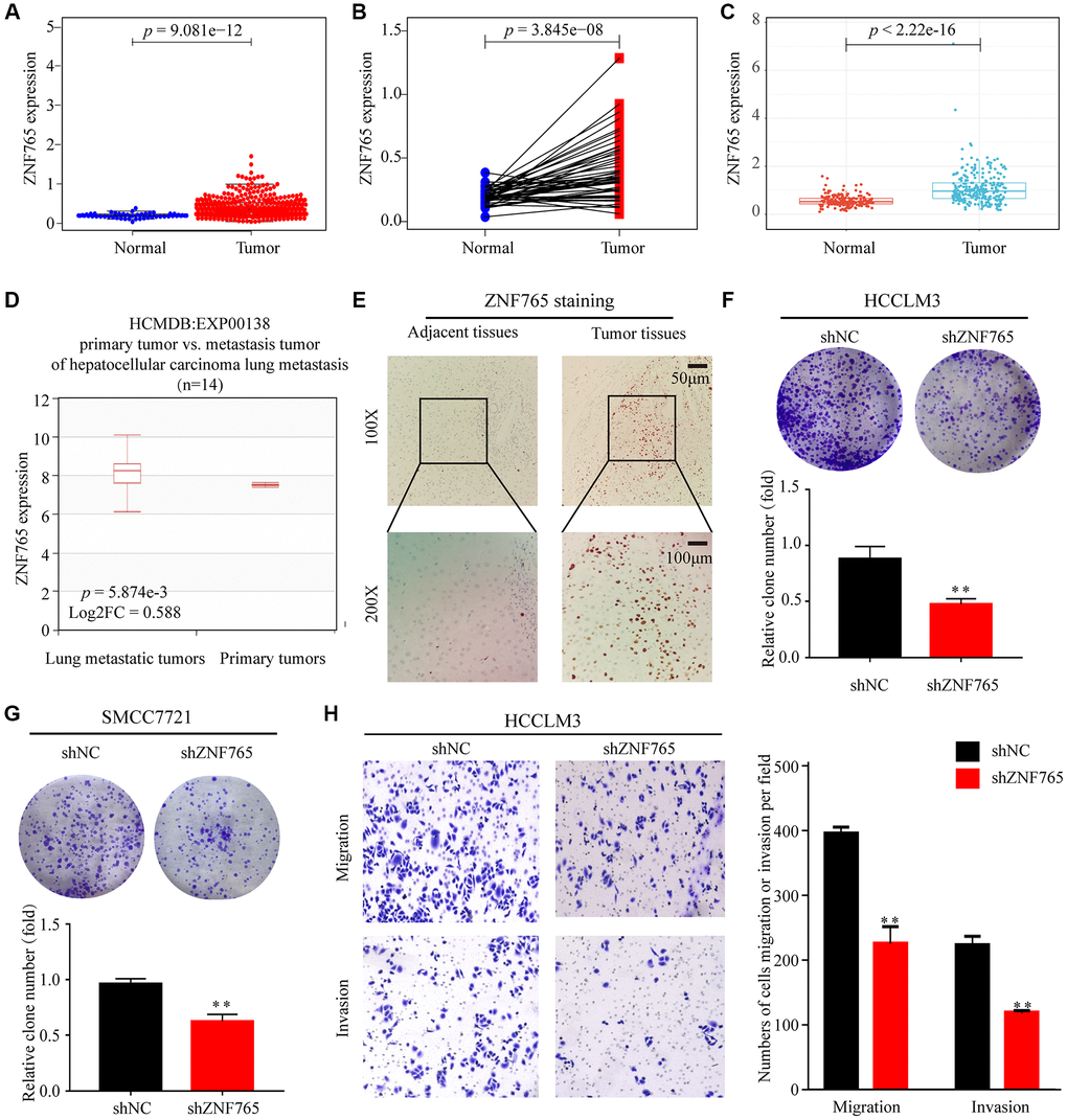 The expression of ZNF765 in HCC and other cancers. (A) ZNF765 mRNA levels in tumor and normal tissues based on the TCGA database (p = 9.061e-12). (B) Paired differential expression map of ZNF765 between 72 pairs of HCC tissues and normal tissues based on the TCGA database (p = 3.845e-08). (C) The mRNA expression level of ZNF765 in tumor and normal tissues in the ICGC (p = 2.22e-16). (D) HCMDB analysis of aberrant expression of ZNF765 in HCC patients. (E) Typical images of immunohistochemistry (IHC) in 40 pairs of HCC tissues showing the protein expression of ZNF765 in HCC and adjacent nontumor tissues. Colonies formed by HCCLM3 (F) and SMCC7721 (G) cells transfected with control shRNA or shRNA targeting ZNF765. The panels are a quantification of the results of the colony formation assay (**p H) Representative data from Transwell migration and invasion assays performed with the ZNF765 knock-down cells.