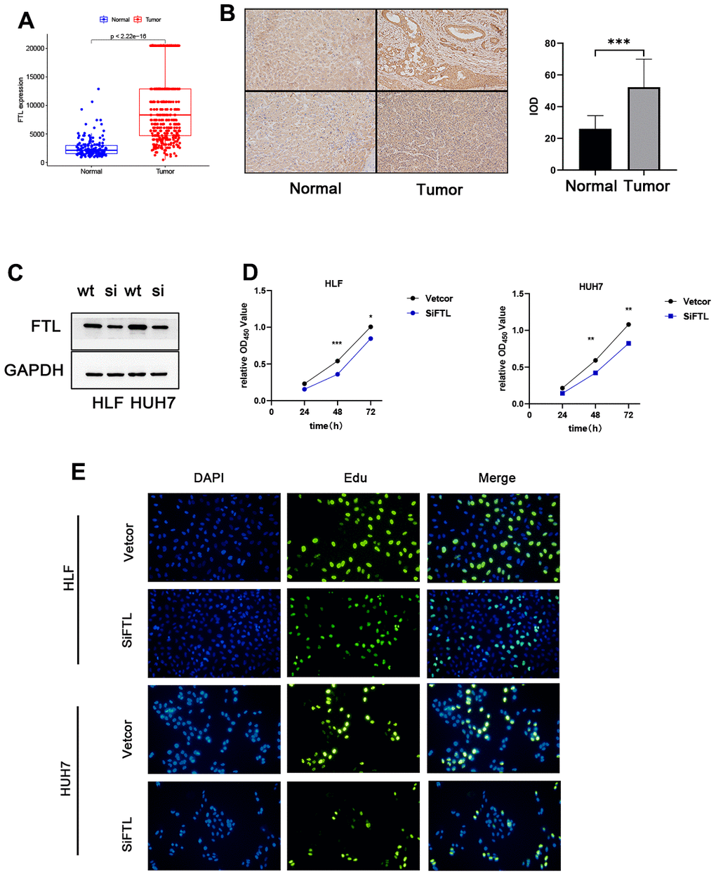 FTL promoted proliferation in HCC. (A) TCGA database analysis indicated that FTL mRNA expression is increased in HCC. (B) Immunohistochemical results suggest that FTL is highly expressed in tumor tissues. (C) Western blot analysis confirmed that the expression of FTL was inhibited by SIRNA. (D) CCK8 assay indicated that FTL inhibition significantly suppressed the proliferation in HCC cells. (E) EdU assays indicated that FTL inhibition significantly suppressed the proliferation in HCC cells. *P 
