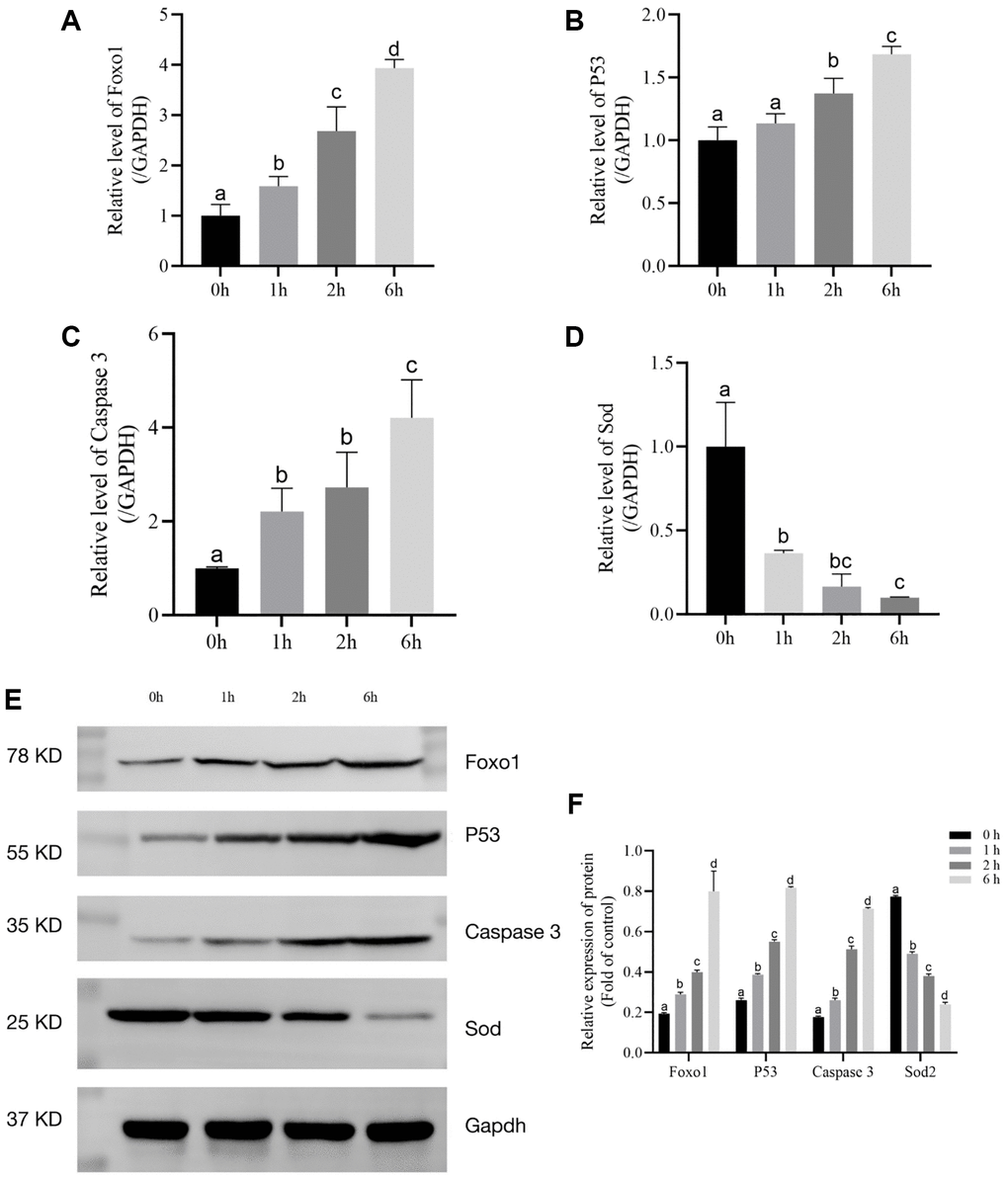 The relative expression levels of Foxo1, P53, Caspase 3, and SOD after t-BHP treatment for 6 h. (A) Relative expression of mRNA level of Foxo1 in t-BHP- induced follicles. (P B) Relative expression of mRNA level of P53 in t-BHP- induced follicles. (P C) Relative expression of mRNA level of Caspase 3 in t-BHP- induced follicles. (P D) Relative expression of mRNA level of SOD in t-BHP-induced follicles. (P E) Relative protein expression levels of Foxo1, P53, Caspase 3, SOD2, and GAPDH in follicles. (F) Statistical analysis of Foxo1, P53, Caspase 3, and SOD2 in follicles. (P 