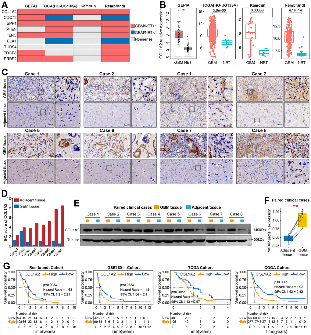 Basic analysis of COL1A2. (A) Summary of the differential expression analysis of nine FARGs in three independent GBM cohorts and the GEPIA website. Red represents up-regulated genes in GBM tissue, while blue represents a down-regulated gene in GBM tissue. Grey represents no statistical difference. (B) Differential expression analysis of COL1A2 between GBM tissues and NBTs in TCGA (HG-UG133A), Kamoun and Rembrandt cohorts, and GEPIA website. (C) Immunohistochemical analysis of COL1A2 protein in eight pairs of GBM tissues and adjacent nontumor tissues. (D) The IHC scores of COL1A2 in GBM tissues and matched adjacent nontumor tissues. (E, F) The protein expression level of COL1A2 in GBM tissues was significantly higher than that in corresponding adjacent tissues. (G) K-M survival curves of OS in GBM patients between the high and low COL1A2 expression groups. *P 