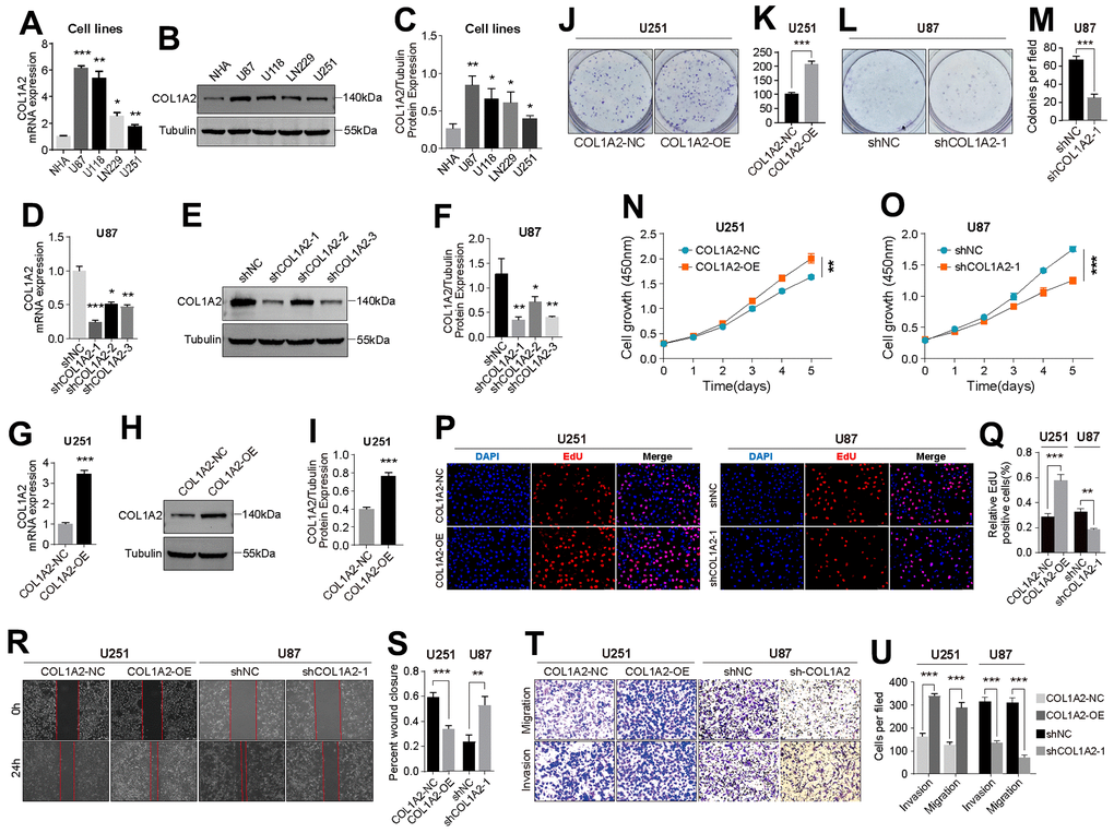 COL1A2 promotes the proliferation, migration, and invasion of GBM cells in vitro. (A–C) Differential expression of COL1A2 at transcriptional (A) and protein levels (B, C) between different GBM cell lines. (D–F) The efficiency of COL1A2 knock-down plasmid at transcriptional (D) and protein levels (E, F) was verified in U87 cells. (G–I) The efficiency of the COL1A2 overexpression plasmid at transcriptional (G) and protein levels (H, I) was verified in U251 cells. In (A–I), data are presented as the mean ± SD. X-axis: four different cell lines. Y-axis: expression level of genes. (J–Q) The proliferation activity of U251 and U87 cells were detected by colony formation assay (J–M), CCK-8 assay (N, O), and EdU staining (P, Q). (R–U) The migration and invasion ability of U87 and U251 cells were detected by wound healing (R, S) and Transwell assays (T, U). The representative photographs were photographed under a microscope. *P