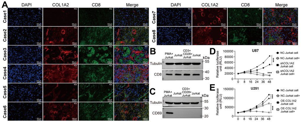 COL1A2 inhibits the effect of activated Jurkat cells on the viability of GBM cells in vitro. (A) Immunofluorescence staining of the nucleus, COL1A2, and CD8 in eight cases of GBM tissues. (B, C) Jurkat cells were stimulated by PMA and ionomycin, or by anti-CD3 and anti-CD28 antibodies. After 24 hours of stimulation, the expression of CD8 and CD69 proteins were detected. (D, E) The viability of U87 (D) and U251 (E) cells were analyzed by measuring luciferase activity. ***P