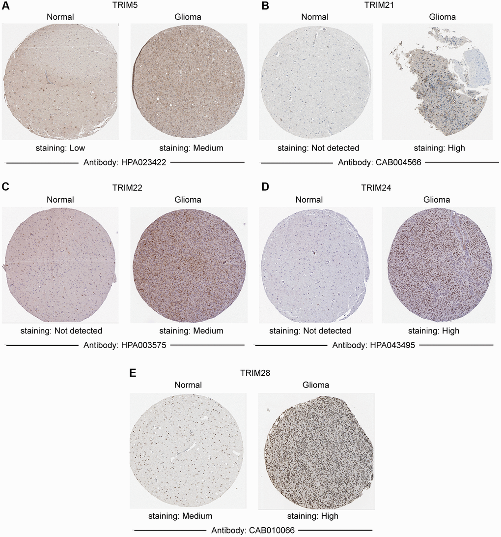 Immunohistochemistry staining of representative. (A) TRIM5; (B) TRIM21; (C) TRIM22; (D) TRIM24; (E) TRIM28 molecules based on the Human Protein Atlas.