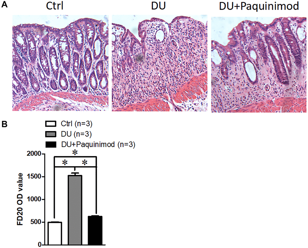 Suppression of S100A8/A9 relieves the development of duodenal ulcer. (A) The representative staining images show hematoxylin-eosin staining of duodenal tissue. (B) FD20 content in serum. Paquinimod: S100A8/A9 inhibitor. *P 