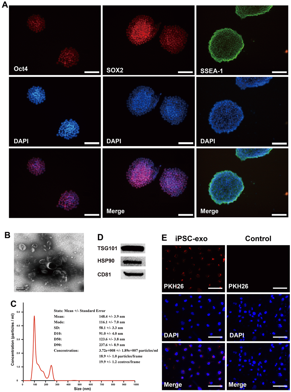 Identification of mouse iPSCs and their exosomes. (A) The cells were stained positive by immunofluorescence technique using specific antibodies for Oct4, SOX2 and SSEA-1. Oct4, octamer-binding transcription factor 4; SOX2, SRY-box transcription factor 2; SSEA-1, stage-specific embryonic antigen-1. (B) Transmission electron microscopy of iPSC-derived exosomes. (C) The concentrations and particle size of the exosomes were determined using nanoparticle tracking analysis. (D) Western blotting analysis was performed to detect the expression TSG101, HSP90, and CD81 in iPSC-derived exosomes. (E) Microscopic analysis of iPSC-derived exosomes taken up by HUVECs. Red, iPSC-derived exosomes labeled with PKH26; blue, the nuclei of HUVECs were counter-stained with DAPI. iPSCs, mouse induced pluripotent stem cells; exo, exosomes. TSG101, tumor susceptibility gene 101 protein; heat shock protein 90; CD31, cluster of differentiation molecule 31.