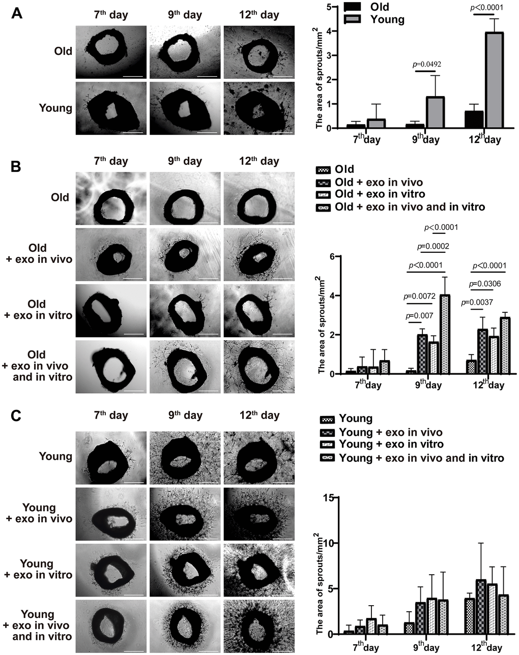 iPSC-derived exosomes significantly increased the neovascularization of aortic rings in old mice. (A) The accumulated neovascularized area of the aortic rings of untreated young mice were significantly higher than that of untreated old mice. (B) Effects of iPSC-derived exosomes on angiogenesis of aortic ring in old mice. Old: the aortic rings of untreated old mice; Old + exo in vivo: the aortic rings of old mice pre-treated with iPSC-derived exosomes by tail vein injection; Old + exo in vitro: the aortic rings of old mice were cultured with iPSC-exosomes in vitro; Old + exo in vivo and exo in vitro: the aortic rings of old mice pre-treated with iPSC-derived exosomes via tail vein injection were cultured with iPSC-derived exosomes in vitro. (C) Effects of iPSC-exosomes on angiogenesis of aortic ring in young mice. Young: the aortic rings of untreated young mice; Young + exo in vivo: the aortic rings of young mice pre-treated with iPSC-derived exosomes via tail vein injection; Young + exo in vitro: the aortic rings of untreated young mice were cultured with iPSC-exosomes in vitro; Young + exo in vivo and exo in vitro: the aortic rings of young mice pre-treated with iPSC-derived exosomes via tail vein injection were cultured with iPSC-exosomes in vitro. Scale bar, 500 μm. Quantification of the area of aortic ring is presented in the right panel. iPSCs, induced pluripotent stem cells; exo, exosomes.