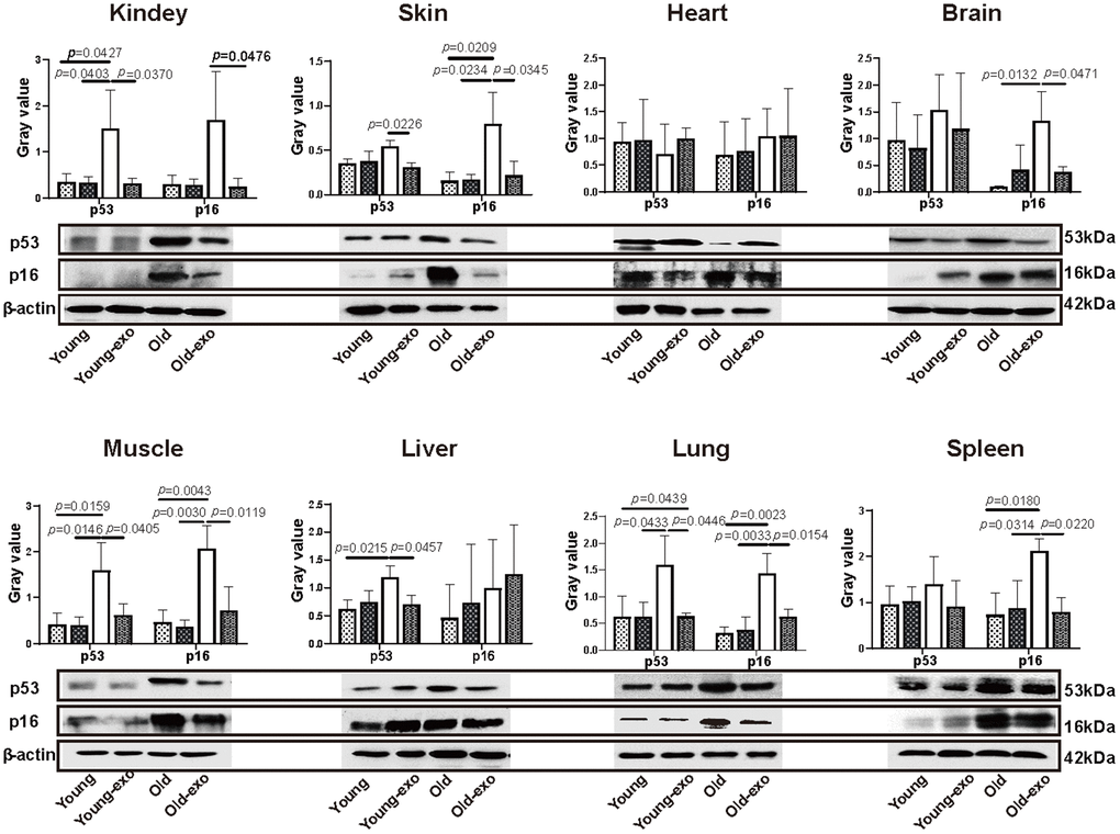 Treatment with iPSC-derived exosomes significantly decreased p53 and P16 expression levels in organs of old mice. Western blot images of p53 and p16 expression in heart, liver, spleen, lung, kidney, brain, skin, and muscle of mice in different treatment groups, and the quantification of the western blot results. β-actin was used as an internal control. Young: untreated young mice; young + exo: young mice pre-treated with iPSC-derived exosomes via tail vein injection; Old: untreated old mice; Old + exo: old mice pre-treated with iPSC-derived exosomes via tail vein injection. iPSCs, induced pluripotent stem cells; exo, exosomes.