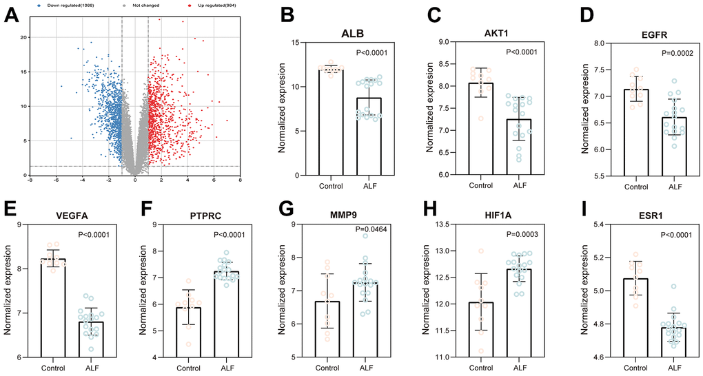 Validation of core targets using the data from the GEO database. (A) Volcano map analysis of ALF. The expression of ALB (B), AKT1 (C), EGFR (D), VGEFA (E) PTPRC (F), MMP9 (G), HIF1A (H), and ESR1 (I).