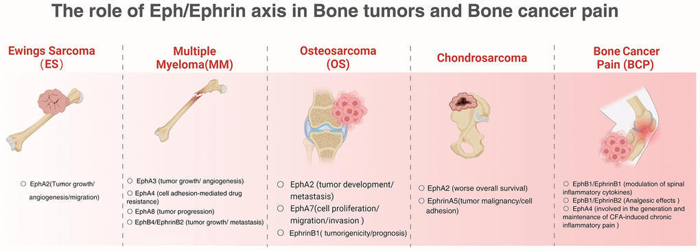 The role of Eph/Ephrin axis in bone tumors and bone cancer pain.