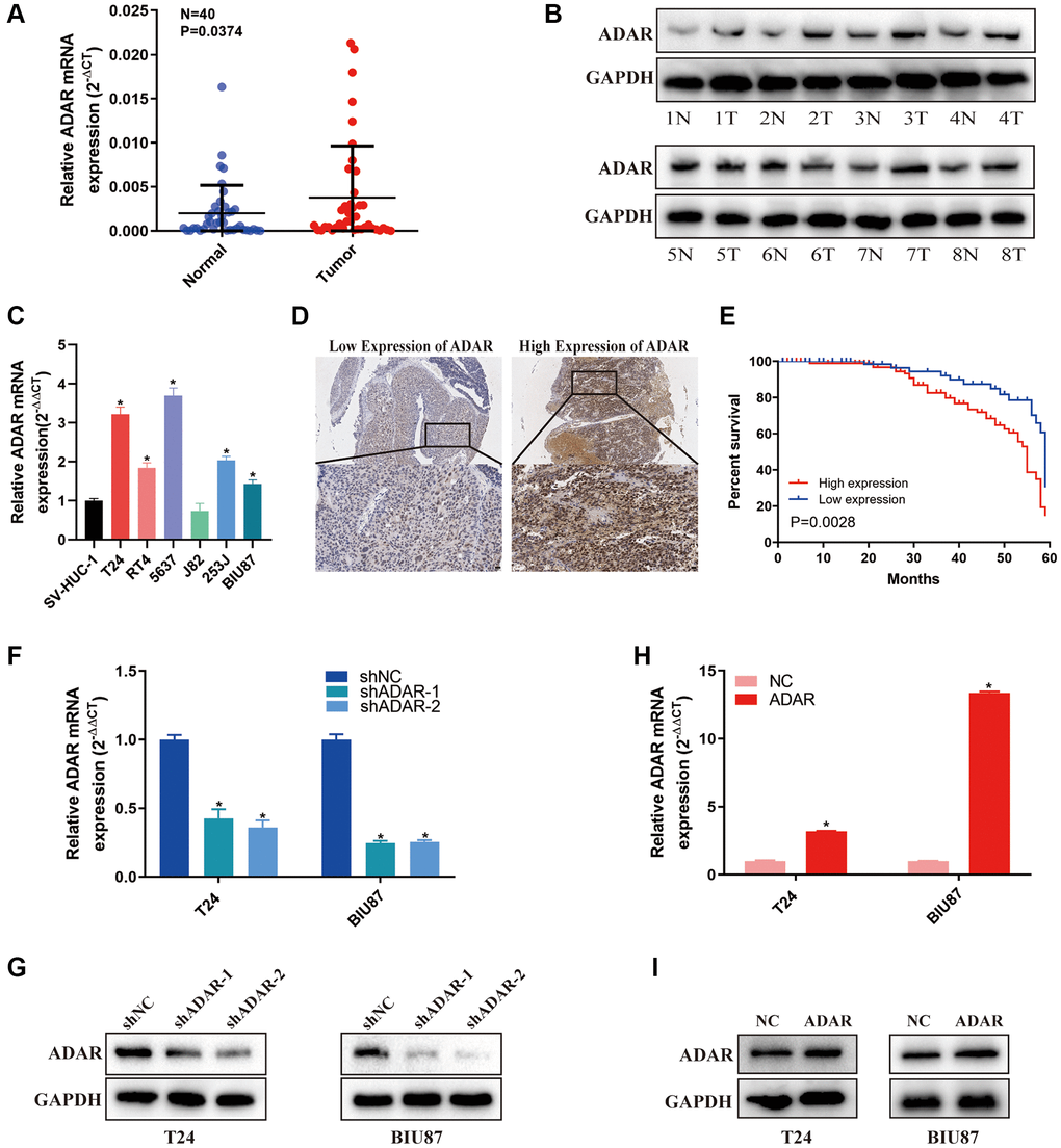 ADAR was up-regulated in bladder cancer tissues and served as a prognostic factor in bladder cancer. (A) Relative expression of ADAR mRNA in the 40 pairs of bladder cancer tissues and matched adjacent normal tissues quantified by qRT-PCR. ADAR was up-regulated in bladder cancer tissues compared with that in adjacent normal tissues. (B) The expression of ADAR protein in 8 pair bladder cancer tissues (T) and adjacent normal tissues (N) by western blot were shown. (C) Relative expression of ADAR in bladder cancer cell lines and normal bladder epithelial cell line SV-HUC-1 by qRT-PCR. Data represent the mean ± SD from three independent experiments, *P D) IHC analysis of ADAR in bladder cancer tissue at 100× and 400× magnification. (E) Kaplan-Meier survival curves of overall survival in 180 bladder cancer patients based on ADAR by IHC staining. The log-rank test was used to compare differences between two groups (P = 0.0028). (F, G) Validation of the knockdown efficacy of ADAR in T24 and BIU87 cell lines by qRT-PCR and western blot. Data represent the mean ± SD from three independent experiments, *P H, I) The overexpression efficacy of ADAR in T24 and BIU87 cell lines by qRT-PCR and western blot. Data represent the mean ± SD from three independent experiments, *P 