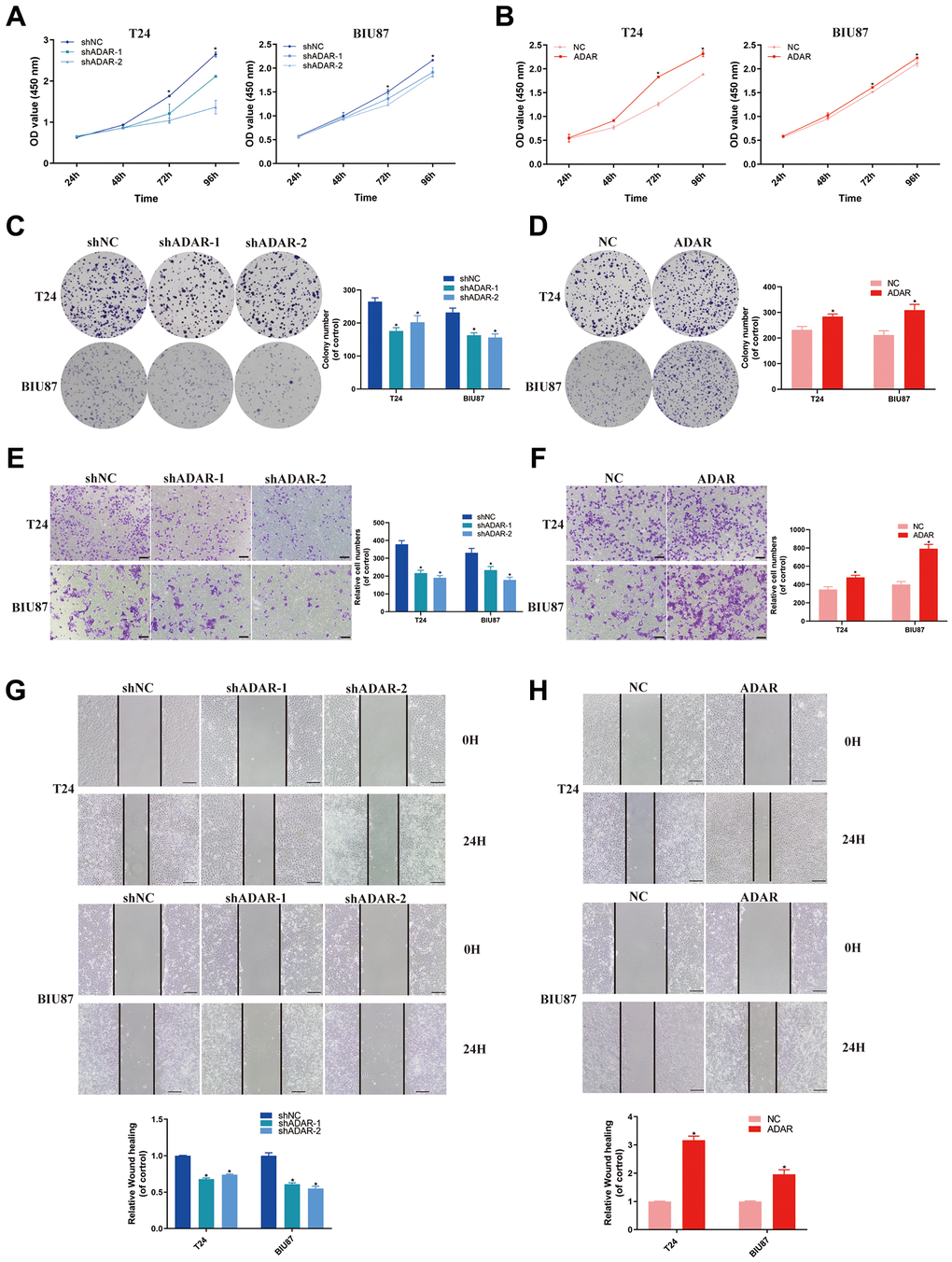 ADAR promoted bladder cancer cell proliferation, invasion and migration in vitro. (A, B) Cell proliferation assessed by CCK8 assays. Knockdown of ADAR inhibited cell proliferation in T24 and BIU87 cells. Overexpression of ADAR promoted cell proliferation in T24 and BIU87 cells. Data represent the mean ± SD from three independent experiments, *P C, D) Colony formation assay showed that knockdown of ADAR significantly decreased the cloning number of T24 and BIU87 cells compared with control group, while ADAR overexpression significantly increased the cloning number of T24 and BIU87 cells. Data represent the mean ± SD from three independent experiments, *P E, F) Invasion assay (Transwell) in T24 and BIU87 cell lines were measured. The results were expressed of crossing cells number per field compared with respective control. Magnification: 100×. Data represent the mean ± SD from three independent experiments, *P G, H) Migration assay (Wound healing) in T24 and BIU87 cell lines were measured. Knockdown of ADAR inhibited cell migration in T24 and BIU87 cells after 24 hours. Overexpression of ADAR promoted cell migration in T24 and BIU87 cells after 24 hours. Data represent the mean ± SD from three independent experiments, *P 