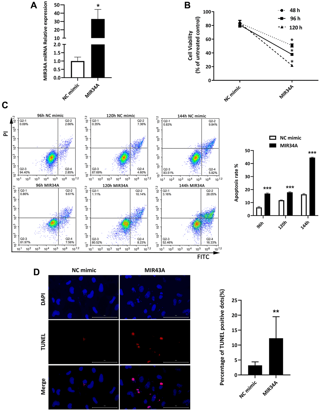 MIR34A is overexpressed in cataracts, inhibiting proliferation and inducing apoptosis of SRA01/04 cells. (A) RT-qPCR analysis was performed to detect the expression of MIR34A after MIR34A mimics were transfected into SRA01/04 cells. (B) SRA01/04 cells were performed as A, the viability of cells was assessed at 48 h, 96 h, and 120 h by CCK-8 after transfected. (C) SRA01/04 cells were performed as A, and the cell apoptosis was assessed at 96 h, 120 h, and 144 h by flow cytometry. (D) SRA01/04 cells were performed as A, the TUNEL assay was performed to detect the apoptosis at 120 h. Scale bars: 100 μm. *P **P ***P 