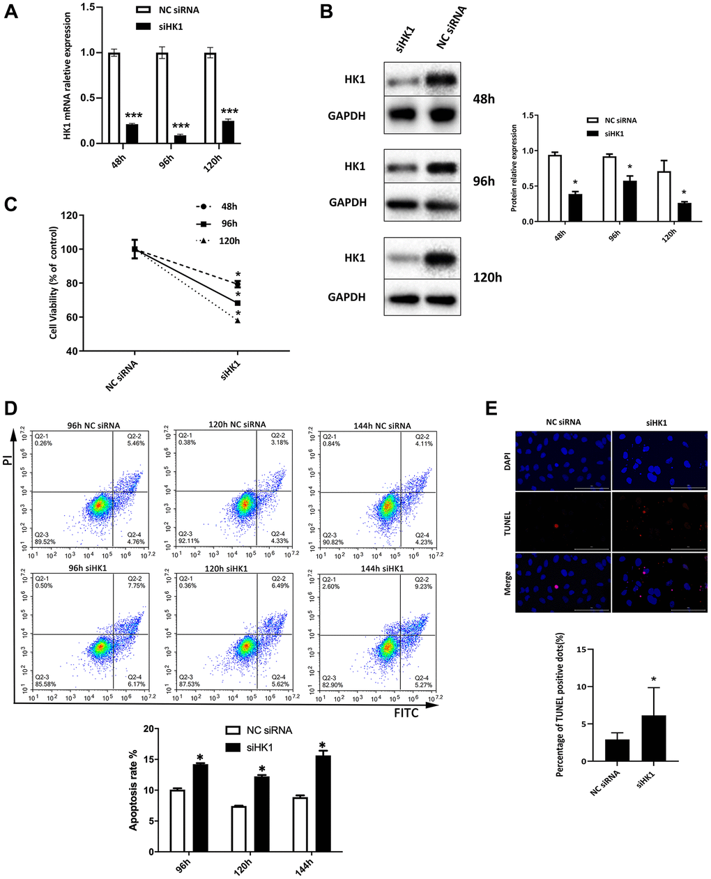 Downregulation in HK1 expression suppresses the proliferation and induces the apoptosis of SRA01/04 cells. (A) SRA01/04 cells were transfected with siRNA HK1, and the effect of siHK1 on HK1 expression in mRNA level was detected by RT-qPCR assay. (B) SRA01/04 cells were performed as A, and the effect of siHK1 on HK1 expression at the protein level was analyzed by western blot. (C) SRA01/04 cells were performed as A, the viability of cells was assessed at 48 h, 96 h, and 120 h by CCK-8 after transfected. (D) SRA01/04 cells were performed as A, cell apoptosis was assessed at 96 h, 120 h, and 144 h and was detected by flow cytometry. (E) SRA01/04 cells were performed as A, cell apoptosis at 120 h by TUNEL assay. Scale bars: 100 μm. *P ***P 