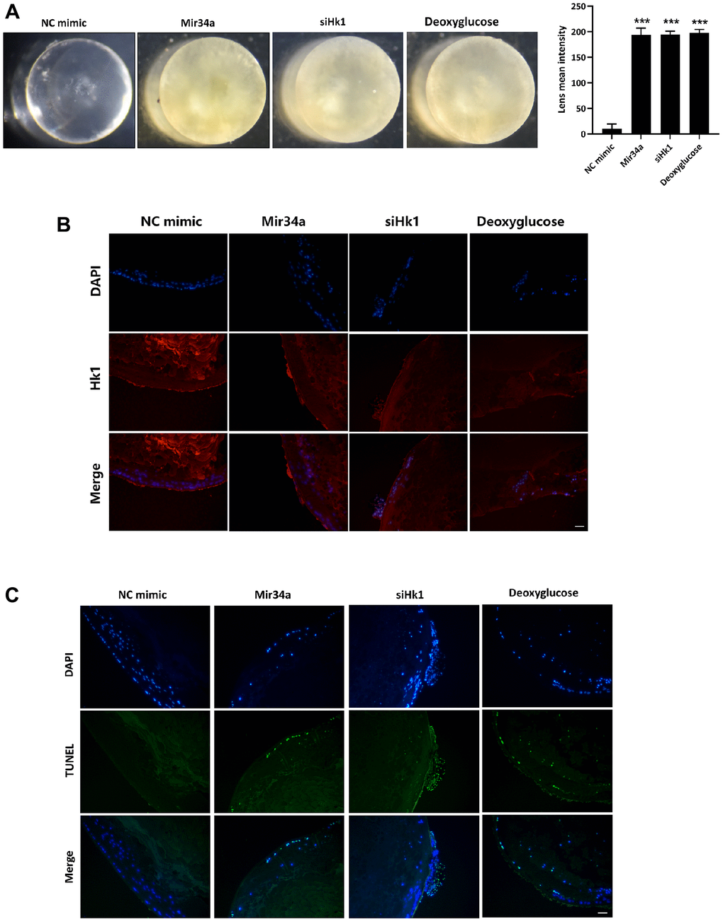 Mir34a modulates the opacification of the lens via the regulation of Hk1 expression. (A) The lens explant of the mouse was co-cultured with Mir34a, siHk1, or deoxyglucose, then the opacification of the lens was observed. (B) Lens explants of the mouse were performed as A, and Hk1 expression on lens epithelium was detected by immunofluorescence. Scale bars: 20 μm. (C) Lens explants of the mouse were performed as A, and the apoptosis of lens epithelium was detected by TUNEL. Scale bars: 20 μm. ***P 