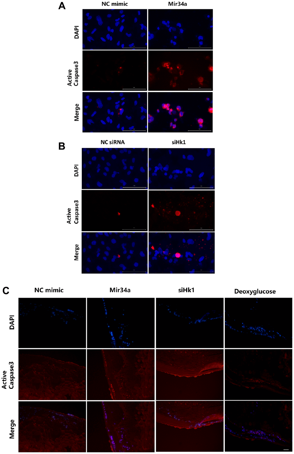 MIR34A modulates LECs apoptosis and cataract development through the HK1/caspase 3 signaling pathway. (A) SRA01/04 cells were transfected with MIR34A mimic and the expression of active caspase 3 at 120 h was detected by immunofluorescence. Scale bars: 100 μm. (B) SRA01/04 cells were transfected with siHK1 and the expression of active caspase 3 at 120 h was detected by immunofluorescence. Scale bars: 100 μm. (C) Lens explants of mice were co-cultured with Mir34a, siHk1, or deoxyglucose, and the expression of active caspase 3 of lens epithelium was detected by immunofluorescence. Scale bars: 20 μm.