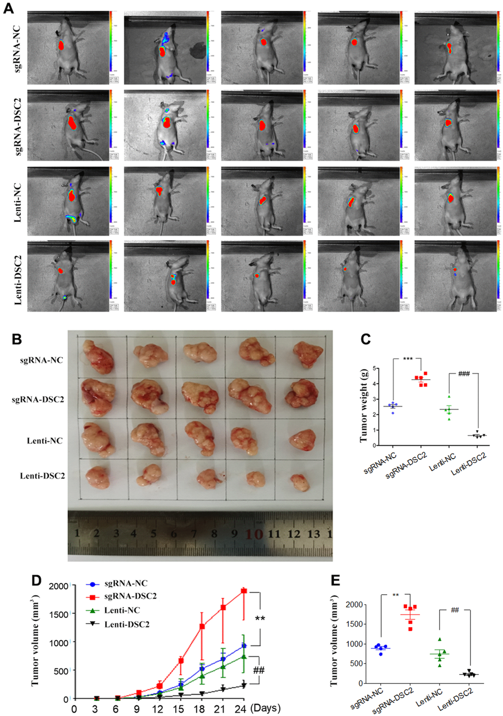 DSC2 suppressed GC growth in vivo. (A) Representative IVIS imaging for scapular bearing tumor. At the day 24, mice were sacrificed and tumors were surgically removed, photoed (B), weighed (C). Tumor volume of mice were measured every 3 days (D), and after removing from the sacrificed mice (E). Data are presented as mean ± SEM (n = 5). **p