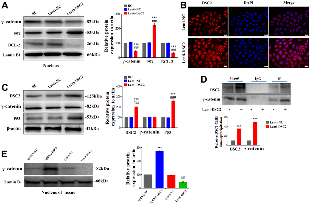 DSC2 inhibited the γ-catenin nuclear translocation of MGC-803 cells by forming DSC2/γ-catenin complex. After stably expressing DSC2 gene of MGC-803 cells, (A) the expression levels of γ-catenin, BCL-2 and P53 in nucleus was determined by Western blot assay. (B) The level of γ-catenin accumulated in the nucleus was detected by immunofluorescence assay. The scale bar = 20 μm. (C) The expressions of γ-catenin and P53 were detected by Western blot assay. (D) Co-IP assay was performed to analyse the interaction between DSC2/γ-catenin by DSC2. The data are represented as mean ± SEM, n=3. ***pE) The expression of γ-catenin in the nucleus of tumor xenograft tissues were detected by Western blot assay. Data are presented as mean ± SEM, n=5. ***p