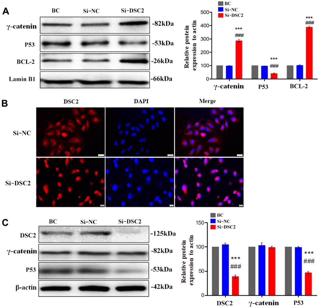 Downregulation of DSC2 expression promoted the γ-catenin nuclear translocation of MGC-803 cells. After being transfected with siDSC2 in MGC-803 cells, (A) the expression level of γ-catenin, BCL-2 and P53 in nucleus was determined by Western blot assay. (B) The distribution of γ-catenin in cells was detected by immunofluorescence assay. The scale bar = 20 μm. (C) The expressions of γ-catenin and P53 were detected by Western blot assay. The data are represented as mean ± SEM, n=3. ***p