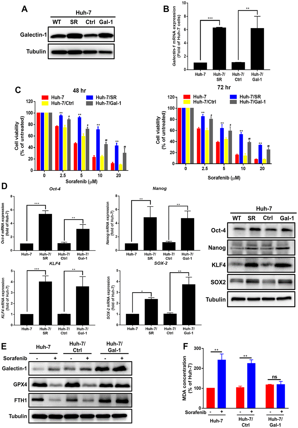 Enhanced sorafenib resistance and suppressed sorafenib-mediated ferroptosis in HCC cells with Galectin-1 overexpression. (A, B) Analysis of Galectin-1 expression in Huh-7, Huh-7/SR, vector control (Huh-7/Ctrl), and Galectin-1 overexpressing Huh-7 (Huh-7/Gal-1) cells through Western blotting and qRT-PCR. (C) Cell viability of HCC cells treated with various doses of sorafenib was examined using the MTT assay. (D) Analysis of cancer stem cell marker (Oct-4, Nanog, SOX-2, and KLF4) expression through qRT-PCR and Western blotting. (E) Detection of Galectin-1, glutathione peroxidase 4 (GPX4), and FTH-1 expression in Galectin-1-overexpressing cells, cells treated with sorafenib (10 μM) for 48 h, and cells not treated with sorafenib. (F) Lipid peroxidation detected using the malondialdehyde (MDA) assay. Data are presented as means ± standard deviations. *P P P t test).