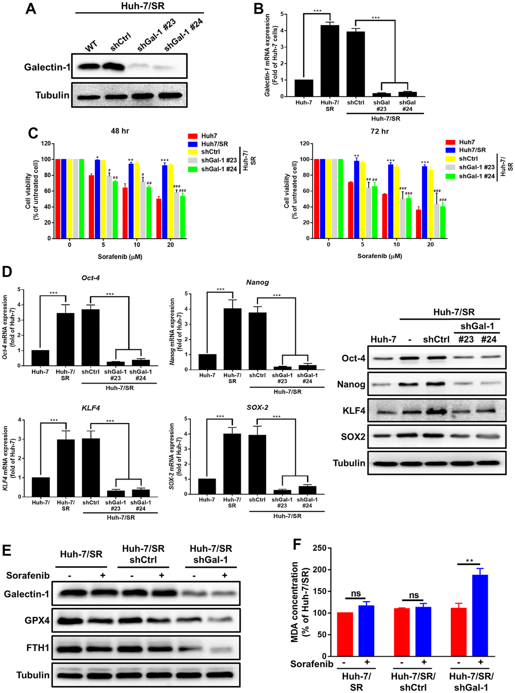 Loss of Galectin-1 overcomes sorafenib sensitivity and promotes ferroptosis in HCC cells. (A, B) Stable Galectin-1-silenced Huh-7/SR (Huh-7/SR/shGal#23 and #24) and control (Huh-7/SR/shCtrl) cells were analyzed using Western blotting and qRT-PCR. (C) Sorafenib sensitivity in indicated cells analyzed for 48 and 72 h by using the MTT assay. (D) qRT-PCR and Western blotting were used to determine the expression of cancer stem cells markers (Oct-4, Nanog, SOX-2, and KLF4). (E) Western blotting analysis of Galectin-1, GPX4, and FTH-1 expression in Galectin-1-knockdown sorafenib-resistant HCC cells, cells treated with sorafenib (10 μM) for 48 h, and cells not treated with sorafenib, respectively. (F) Lipid peroxidation determined using the MDA assay. Data are presented as means ± standard deviations. *P P P P P t test).