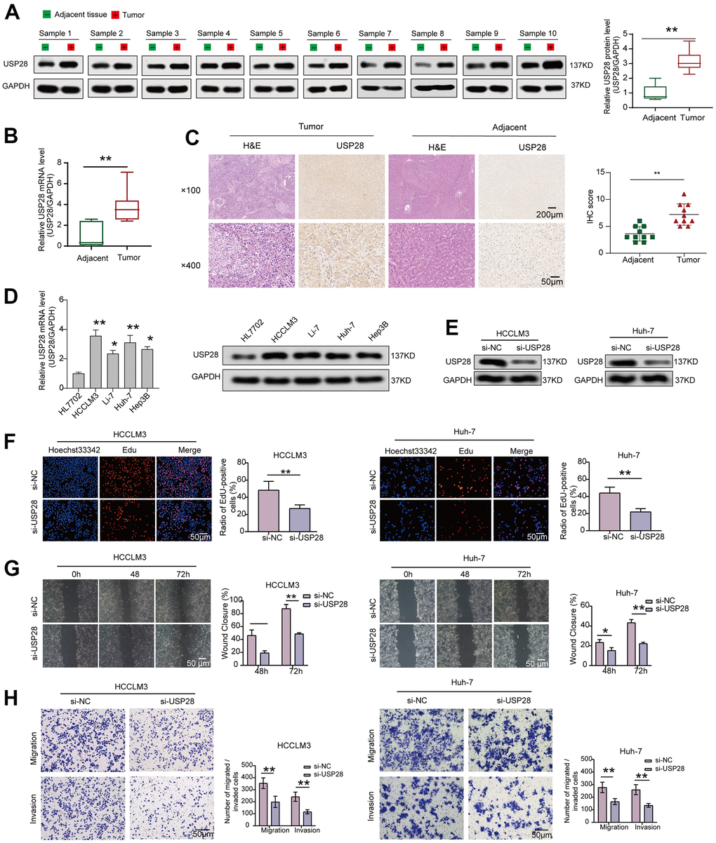 Interfering with the expression of USP28 inhibited cell lines proliferation, migration, and invasion. (A) The protein level of USP28 in HCC and normal tissues. (B) Relative mRNA expression of USP28 in HCC tissues compared to normal tissues. (C) Immunohistochemical staining of USP28 in HCC tissue and adjacent tissue. (D) qPCR and Western blotting analysis of USP28 mRNA and protein expression in four HCC cell lines (HCCLM3, Li-7, Huh-7, Hep3B) and normal liver cell line (HL7702). GAPDH was used as an internal control. (E) The efficiency of USP28 siRNA (si-USP28) in HCCLM3 and Hep3B was confirmed by Western blotting. (F) EdU assays for HCCLM3 and Huh-7 were performed to evaluate cell proliferation ability after transfecting si-USP28. (G, H) Scratch wound healing assay and transwell assays assessed the migration and invasion abilities in HCCLM3 and Huh-7 cells. (Original magnification, ×200; scale bars, 50 μm). *p p p 