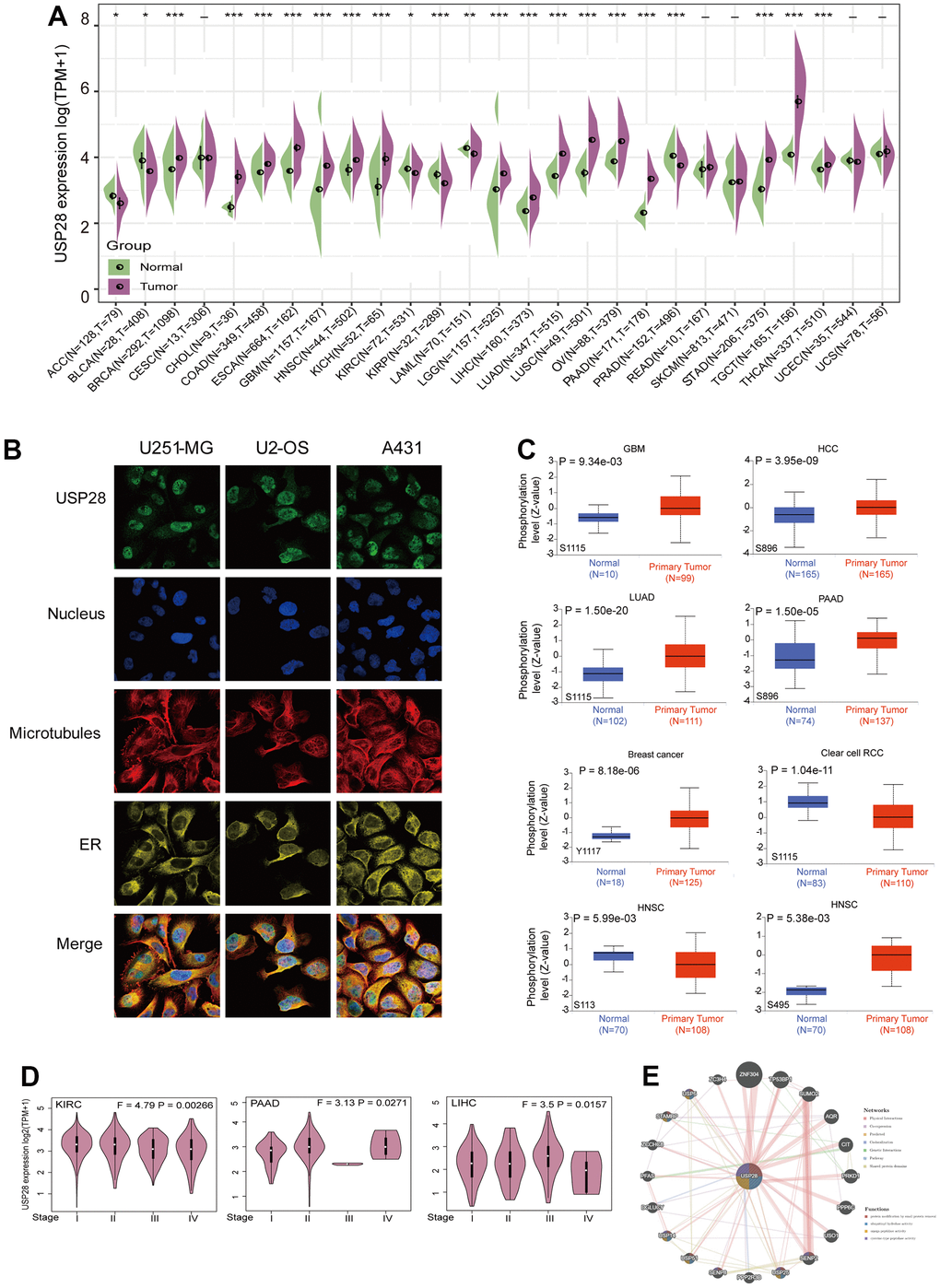 Clinical landscape of USP28 expression levels in pan-cancer. (A) The difference in USP28 expression between tumor and normal tissues in different cancers through TCGA and GTEx datasets. (B) The immunofluorescence images of the USP28 protein, nucleus, endoplasmic reticulum (ER), microtubules, and the merged images in U251-MG, U2-OS, and A431 cell lines. (C) Based on the CPTAC dataset, the expression level of USP28 phosphoprotein, including Y1117, S1115, S896, S113, and S495, between normal tissue and primary tissue of selected tumors via the UALCAN. (D) The correlation of USP28 expression levels with pathological stages (stage I stage II, stage III, stage IV) was analyzed using the TCGA dataset. Log2 (TPM+1) was applied for the log scale. (E) PPI network to identify the USP28-interacting proteins using the GeneMANIA database. *p p p 