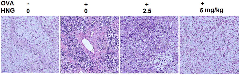 S14G-Humanin (HNG) improved pathological changes in ovalbumin (OVA)- induced murine model of chronic asthma. Hematoxylin and eosin (H&E) staining of lung tissue. Scale bar, 200 μm.