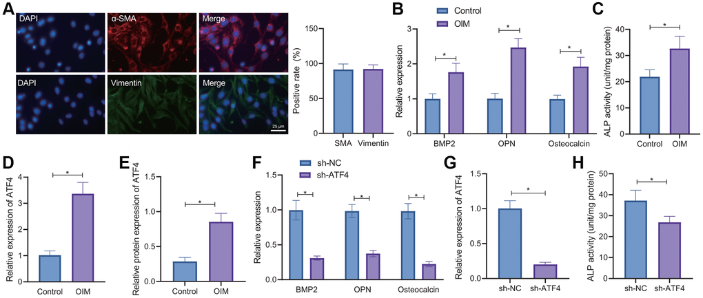 ATF4 knockdown delays the osteogenic differentiation of VICs. (A) IF staining of α-SMA and vimentin proteins in the VICs isolated from non-calcified valve tissues. (B) RT-qPCR detection of BMP2, OPN, and osteocalcin expression in the VICs induced by OIM and normal culture medium. (C) ALP activity in the OIM-induced VICs. (D) RT-qPCR detection of ATF4 expression in the VICs induced by OIM. (E) Western blot analysis of ATF4 protein in the OIM-induced VICs. (F) RT-qPCR detection of ATF4 expression in the OIM-induced VICs treated with sh-ATF4. (G) RT-qPCR detection of BMP2, OPN, and osteocalcin expression in the OIM-induced VICs treated with sh-ATF4. (H) ALP activity in the OIM-induced VICs treated with sh-ATF4. *p t-test.