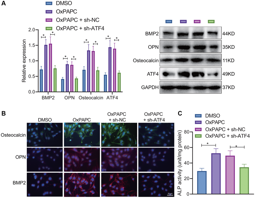 OxPAPC-polarized macrophages promote osteogenic differentiation of VICs through ATF4. OxPAPC- or DMSO- polarized macrophages were co-cultured with VICs transduced with sh-ATF4. (A) The protein expression of BMP2, OPN and osteocalcin detected by Western blot. (B) The protein expression of BMP2, OPN and osteocalcin detected by IF. (C) ALP activity determination. *p n = 8. Cell experiments were repeated three times independently. Measurement data were expressed as mean ± standard deviation. Data obeying normal distribution and homogeneity of variance between two groups were analyzed using unpaired t-test. Data obeying normal distribution and homogeneity of variance among multiple groups were analyzed by one-way ANOVA with Tukey’s post hoc tests.