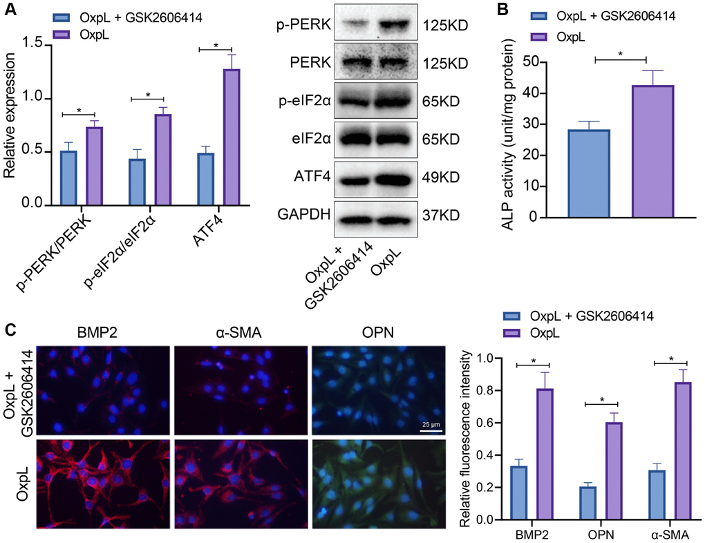 OxPL up-regulates ATF4 expression through PERK/eIF2α pathway. (A) OxPAPC polarized macrophages and VICs were co-cultured, followed by addition of PERK inhibitor, and the phosphorylation levels of PERK and eIF2α as well as ATF4 expression in VICs was detected by Western blot. (B) ALP activity determination. (C) BMP2, α-SMA and OPN expression in VICs was detected by IF. *p t-test, while those among multiple groups were analyzed by one-way ANOVA with Tukey’s post hoc tests.