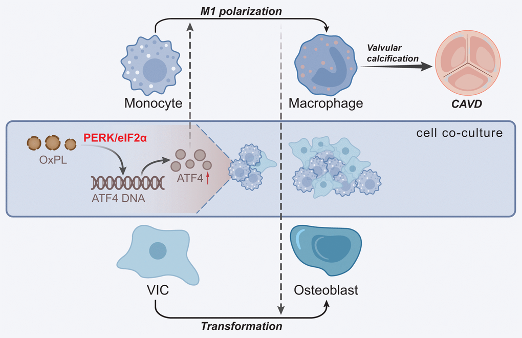 Molecular mechanism underlying the role of OxPL in CAVD. OxPL promotes the M1 polarization of macrophages by up-regulating the expression of ATF4, thereby enhancing the osteogenic differentiation of VICs and formation of AVC, ultimately promoting the occurrence of CAVD.