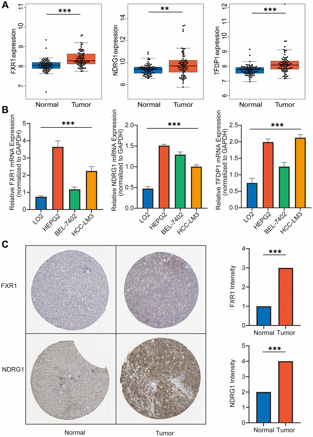 Experiment in vitro and in vivo. (A) Expression of FXR1, NDRG1 and TFDP1 was significantly higher in hepatocellular carcinoma tissues than in normal liver tissues by GEO dataset. (B) The expression of FXR1, NDRG1 and TFDP1 was found to be significantly higher in three types of hepatocellular carcinoma cells than in normal hepatocytes by RT-qPCR assay. (C) The expression of FXR1 and NDRG1 was found to be significantly higher in hepatocellular carcinoma tissues than in normal liver tissues using the HPA database.