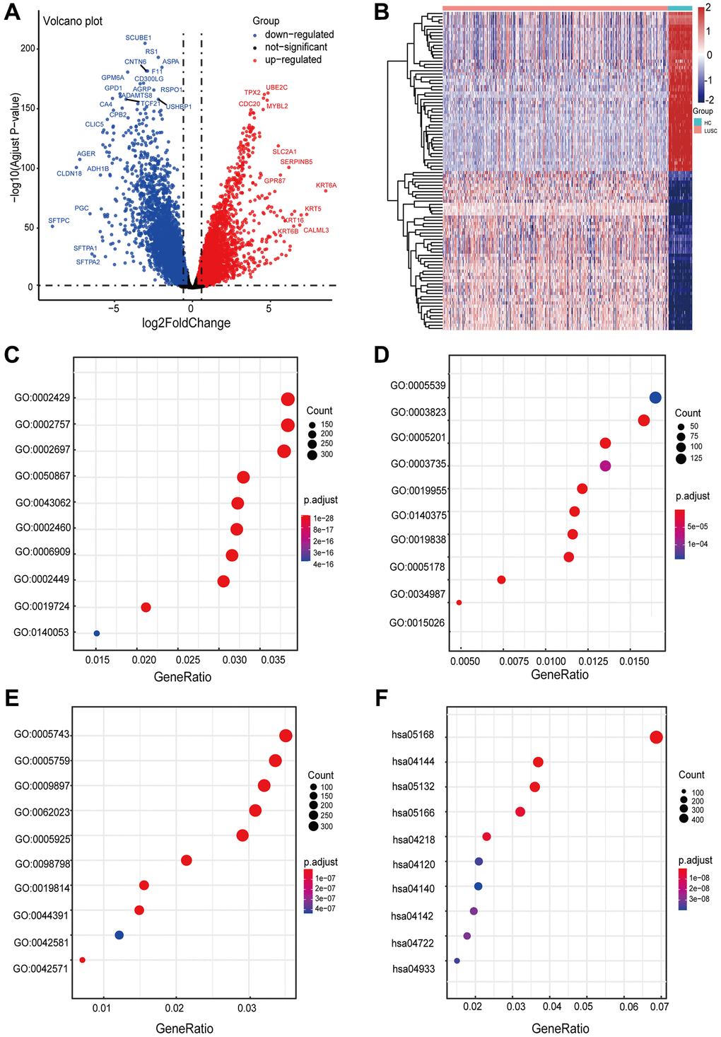 Visualization of differentially expressed EMT-related genes and functional enrichment analysis of DEGs in LUSC. (A) The volcano plot for differentially expressed genes between LUSC and normal samples. (B) The heatmap for differentially expressed genes between LUSC and normal samples. (C–F) Significantly enriched pathways in biological processes (BP), molecular function (MF), cellular components (CC) and KEGG pathway. The size of the dots represents the number of enriched genes, while their color indicates the degree of enrichment.